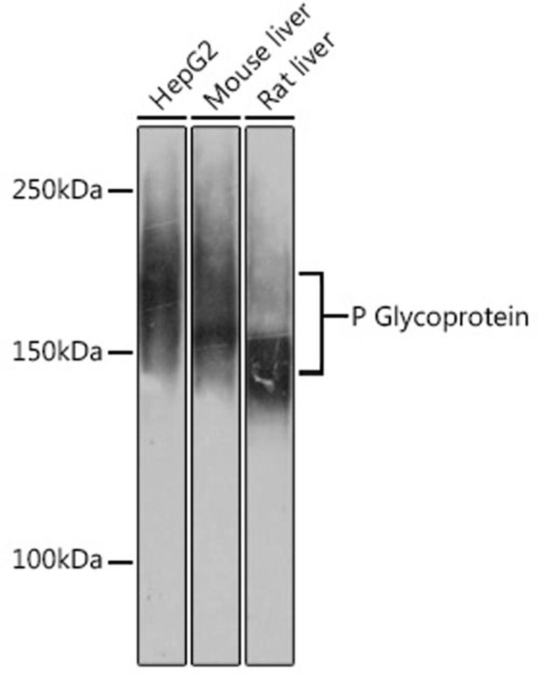Western blot - P Glycoprotein antibody (A19093)