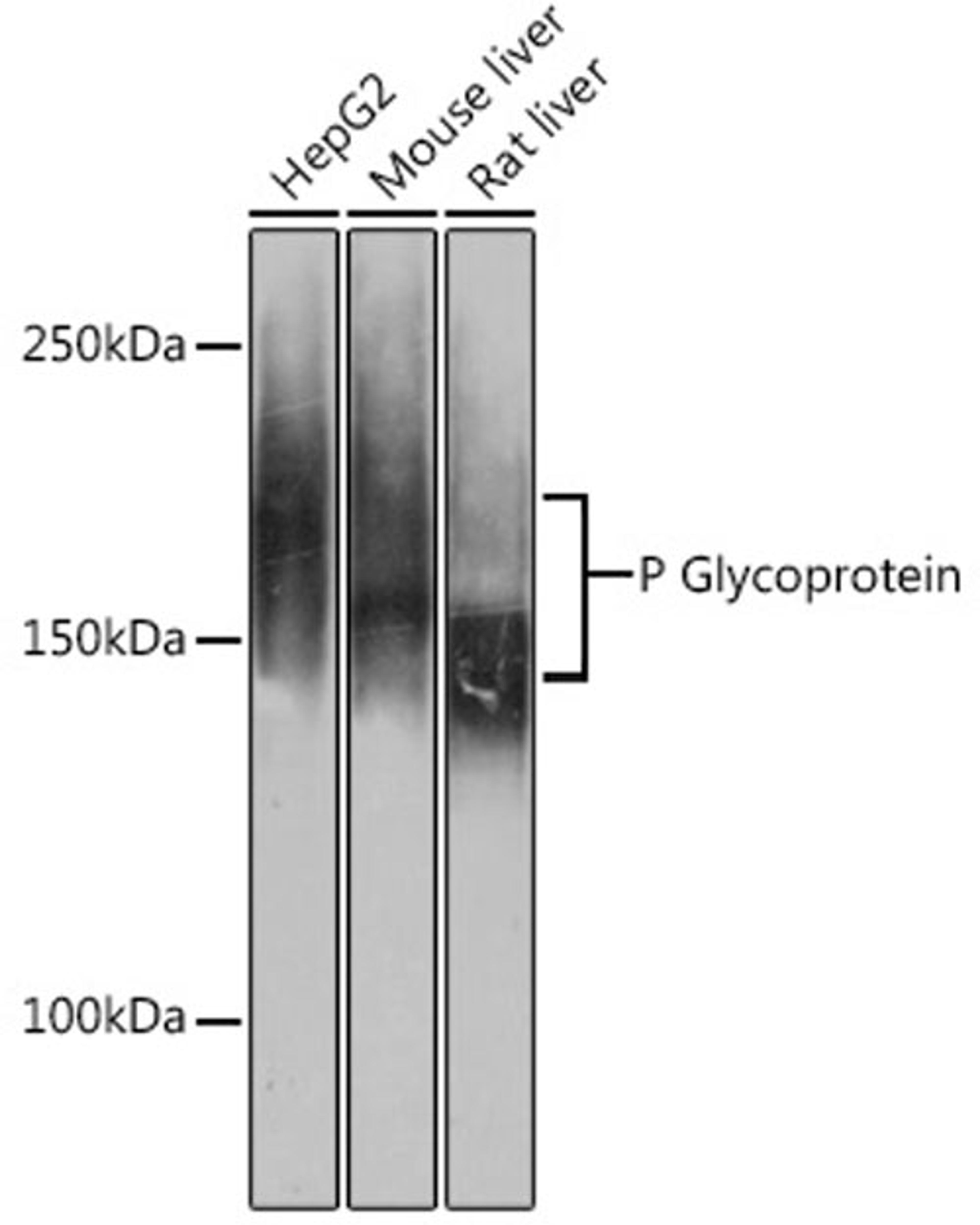 Western blot - P Glycoprotein antibody (A19093)