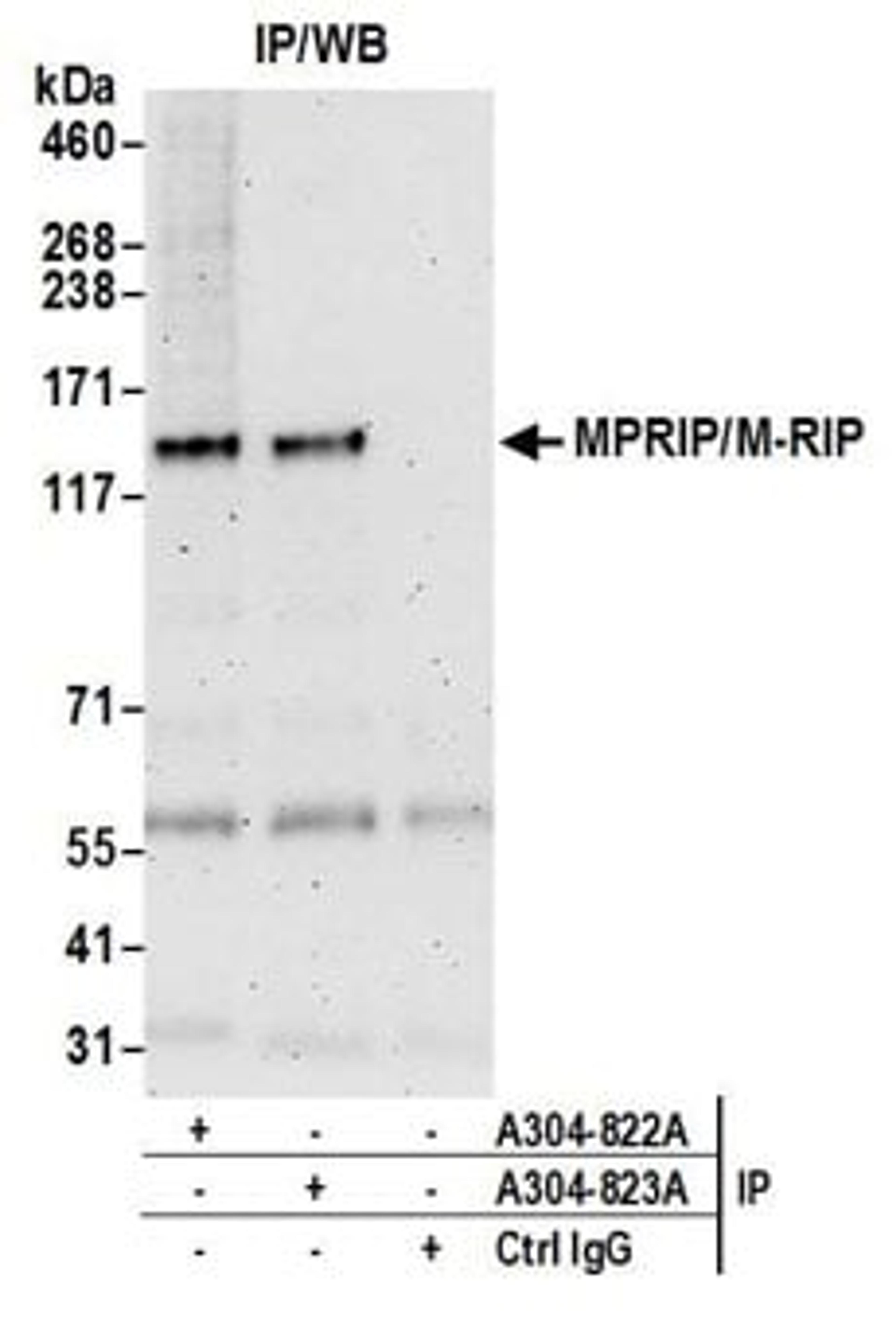 Detection of human MPRIP/M-RIP by western blot of immunoprecipitates.