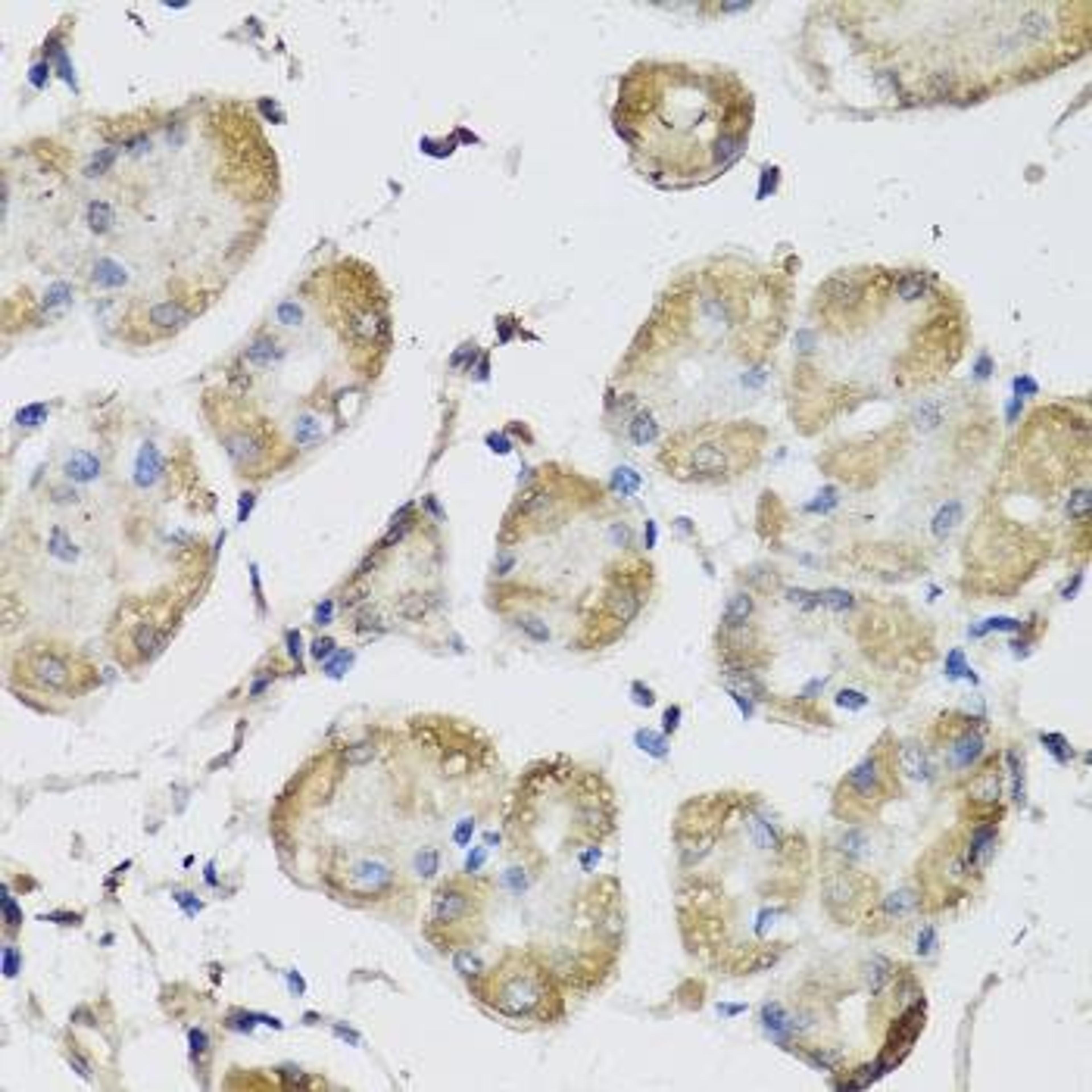 Immunohistochemical staining of rat heart tissue using USH1C antibody (dilution of 1:100)