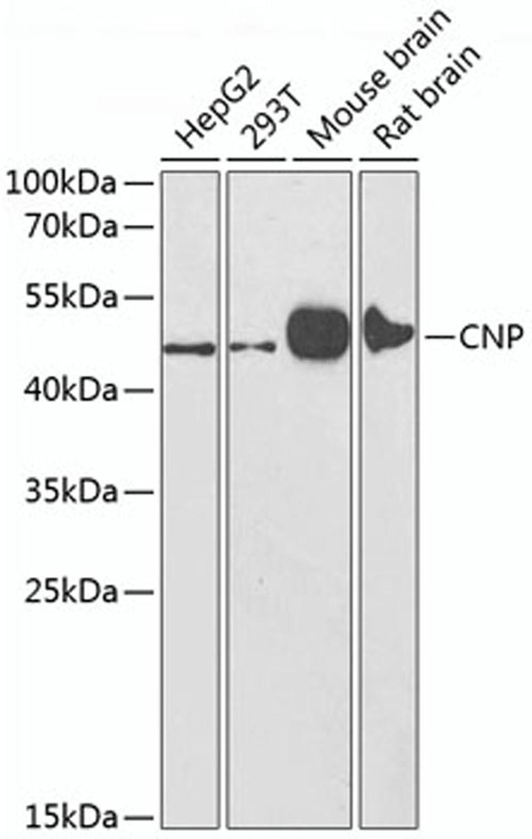 Western blot - CNP antibody (A1018)