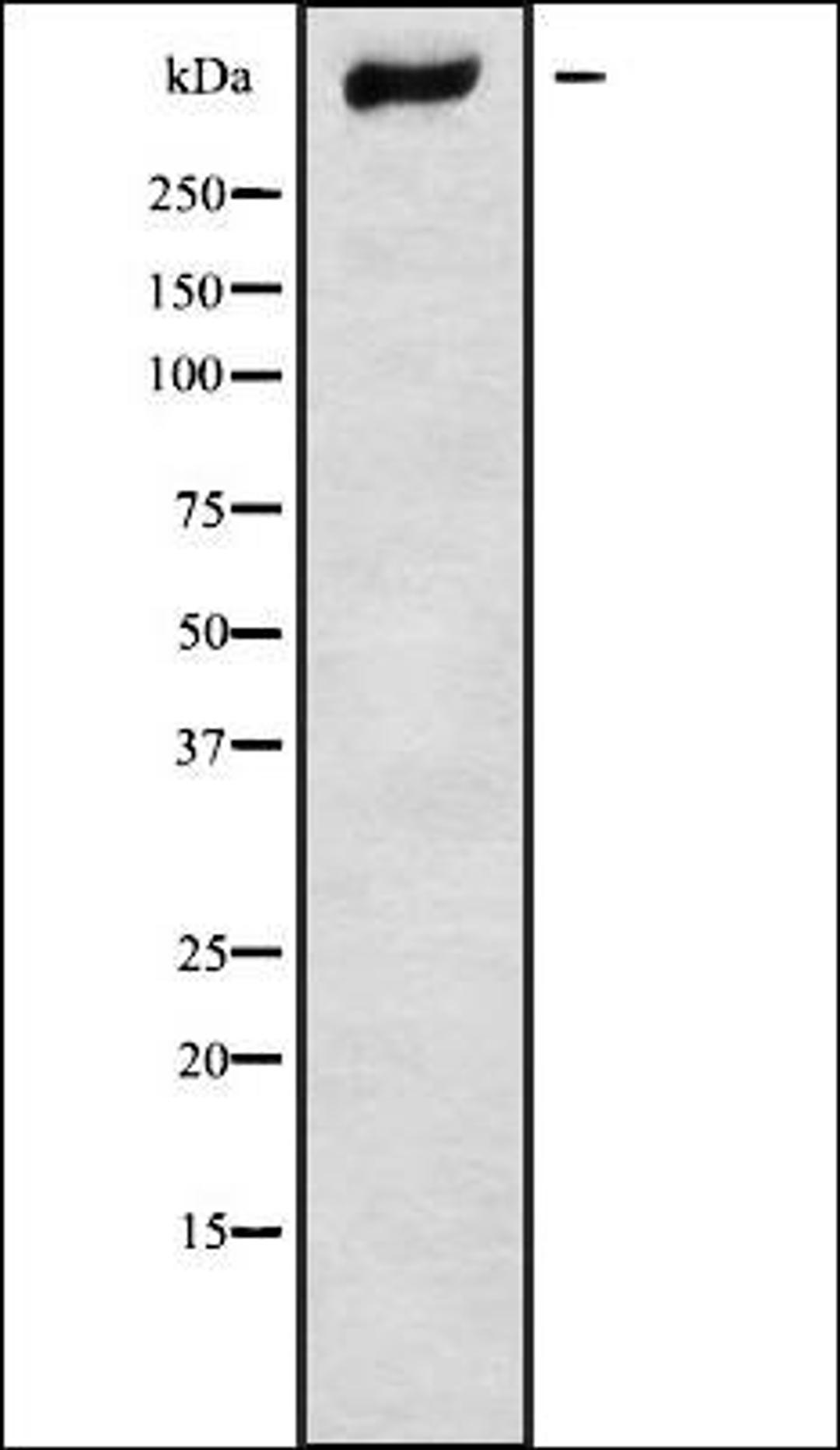 Western blot analysis of Jurkat whole cell lysates using CHD9 antibody