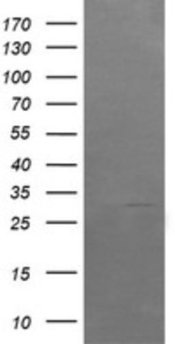 Western Blot: ARMC1 Antibody (1D10) [NBP2-46543] - Analysis of HEK293T cells were transfected with the pCMV6-ENTRY control (Left lane) or pCMV6-ENTRY ARMC1.