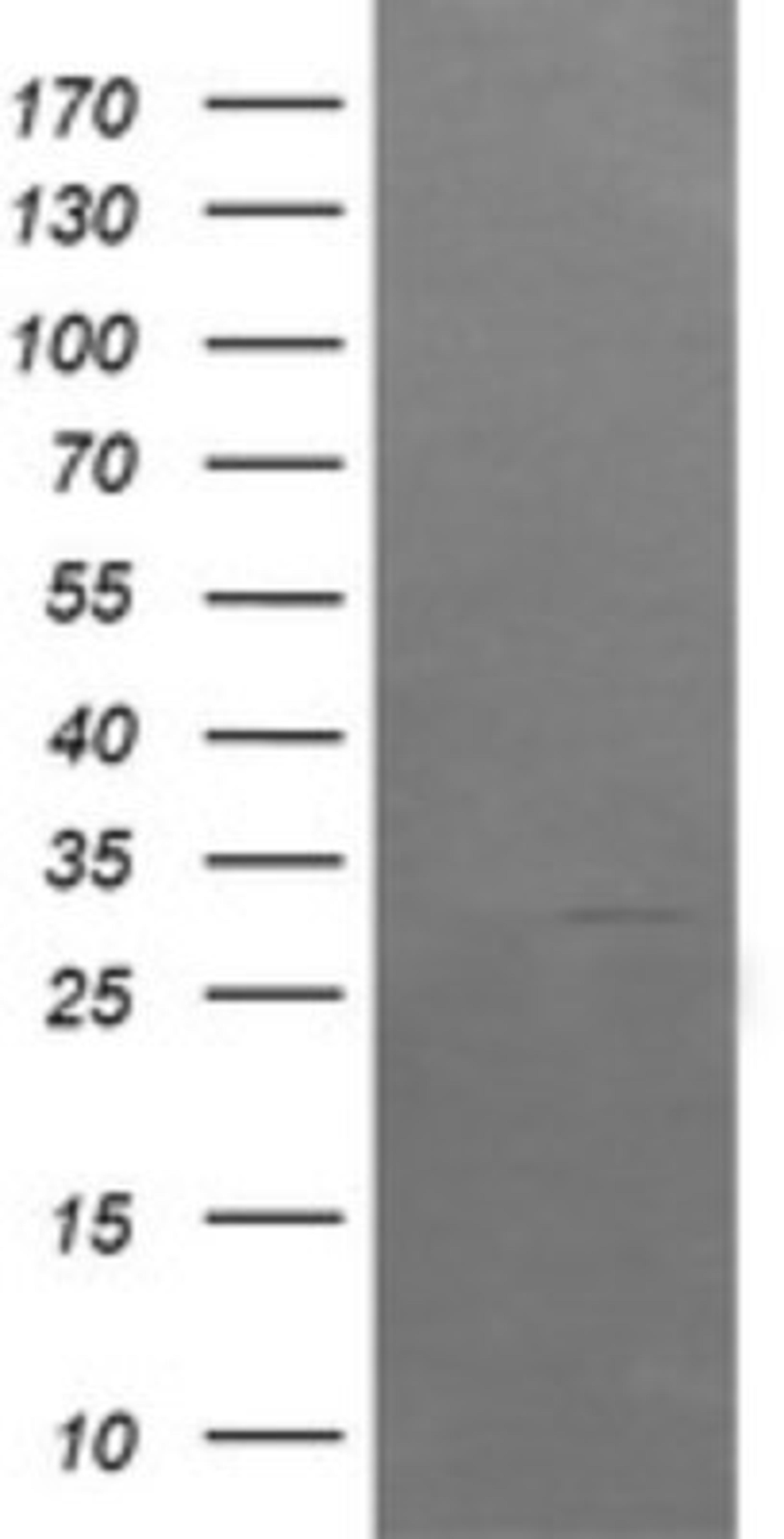 Western Blot: ARMC1 Antibody (1D10) [NBP2-46543] - Analysis of HEK293T cells were transfected with the pCMV6-ENTRY control (Left lane) or pCMV6-ENTRY ARMC1.