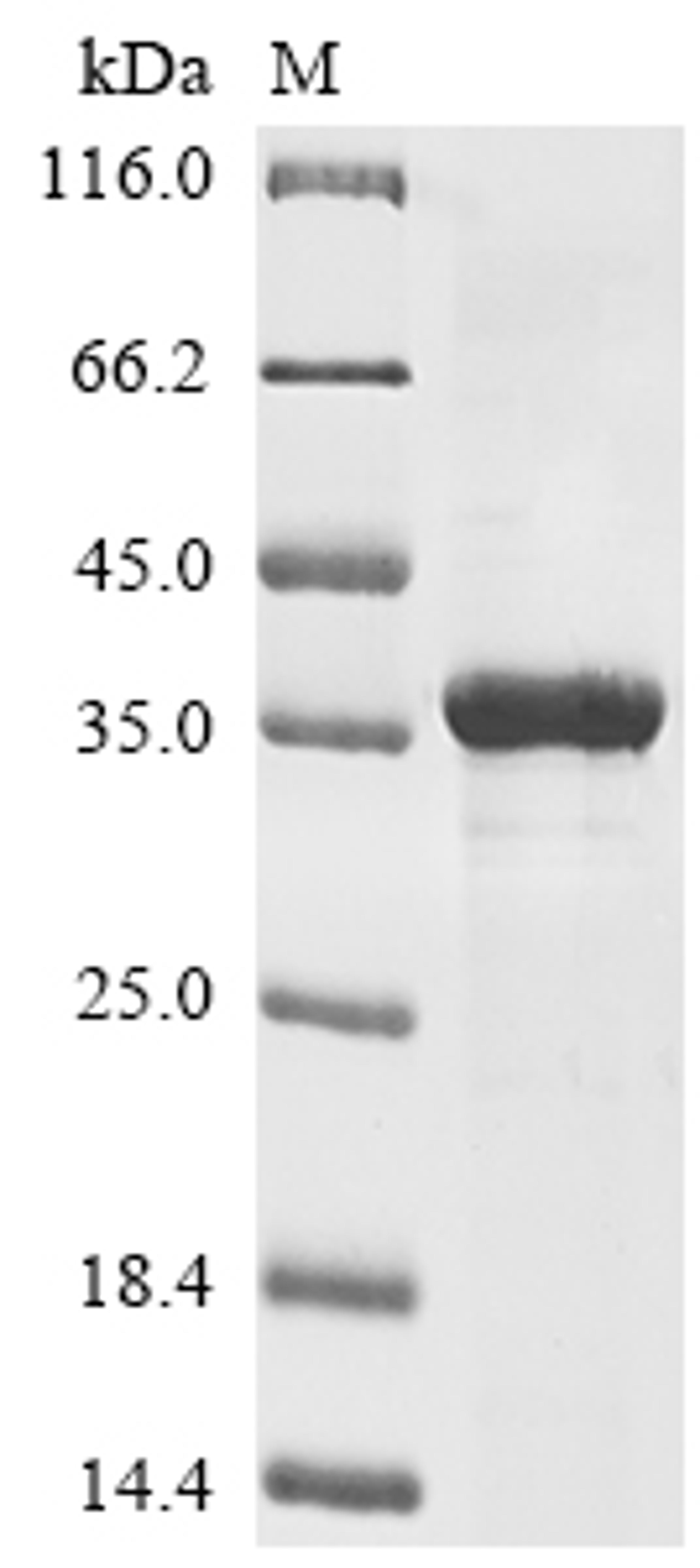 (Tris-Glycine gel) Discontinuous SDS-PAGE (reduced) with 5% enrichment gel and 15% separation gel.