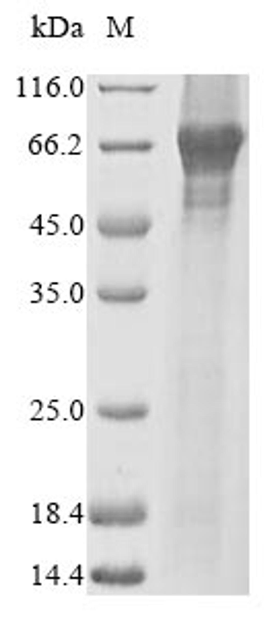 (Tris-Glycine gel) Discontinuous SDS-PAGE (reduced) with 5% enrichment gel and 15% separation gel.