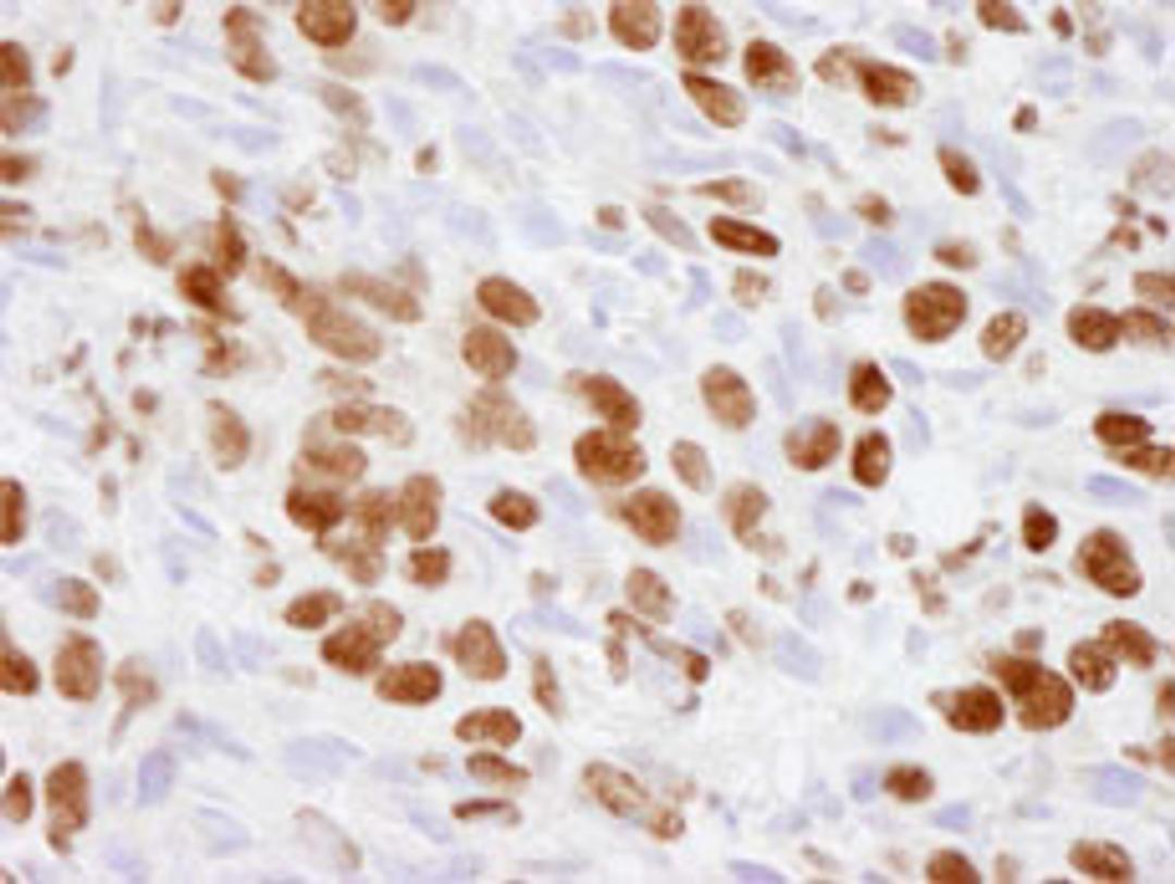 Detection of human p300 by immunohistochemistry.