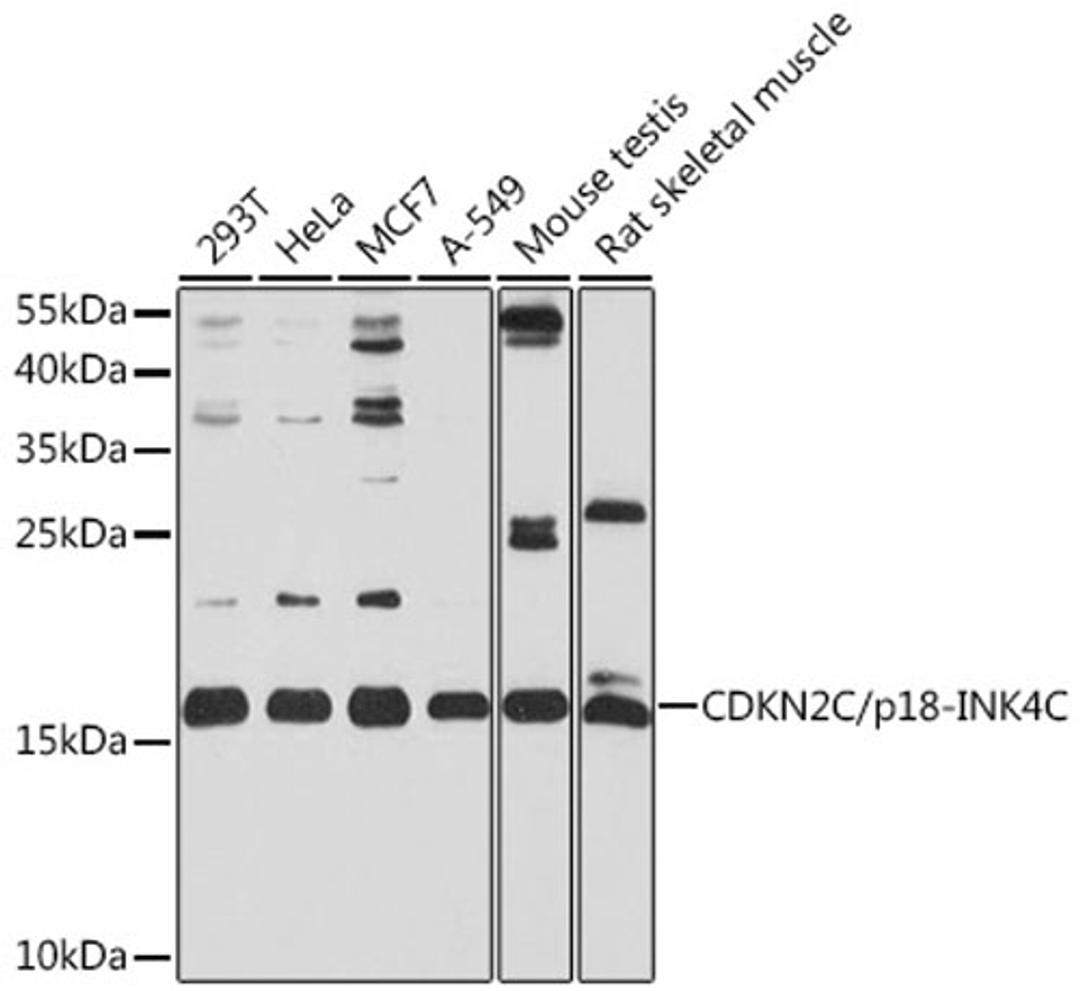 Western blot - CDKN2C/p18-INK4C antibody (A2042)