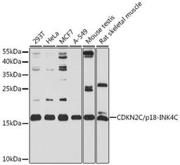 Western blot - CDKN2C/p18-INK4C antibody (A2042)