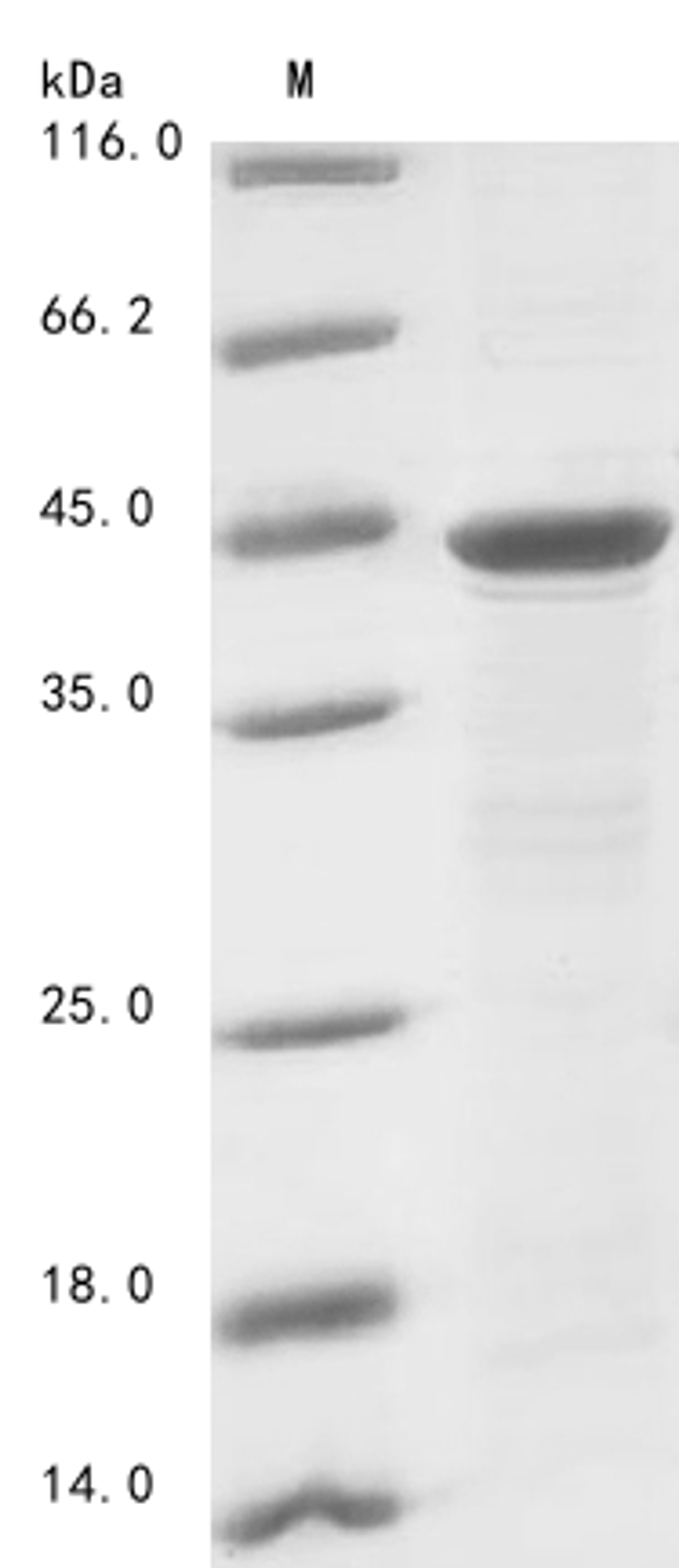 (Tris-Glycine gel) Discontinuous SDS-PAGE (reduced) with 5% enrichment gel and 15% separation gel.