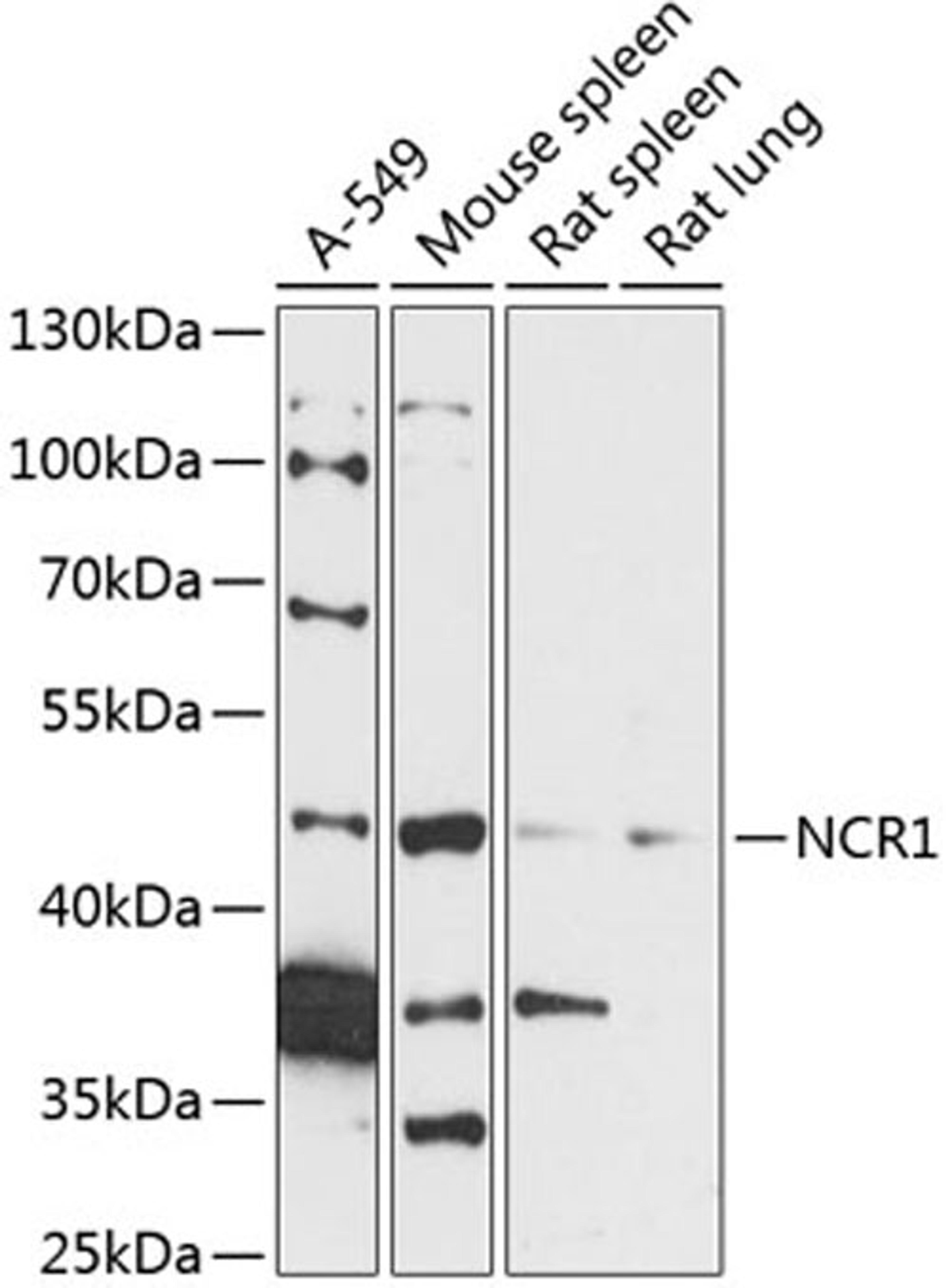 Western blot - NCR1 antibody (A14499)