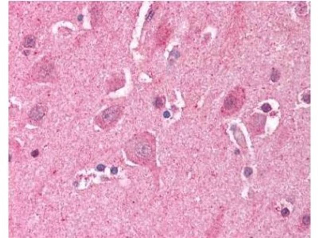 Immunohistochemistry-Paraffin: LDB2 Antibody [NB600-480] - This antibody was used at a 5ug/mL in human brain cortex tissue. The image shows the localization of antibody as the precipitated red signal, with a hematoxylin purple nuclear counter stain. Tissue was formalin-fixed and paraffin embedded.