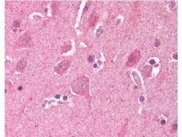 Immunohistochemistry-Paraffin: LDB2 Antibody [NB600-480] - This antibody was used at a 5ug/mL in human brain cortex tissue. The image shows the localization of antibody as the precipitated red signal, with a hematoxylin purple nuclear counter stain. Tissue was formalin-fixed and paraffin embedded.