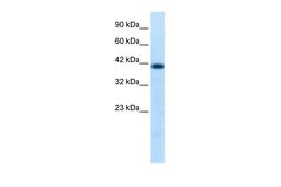 Antibody used in WB on Human Jurkat 0.2-1 ug/ml.