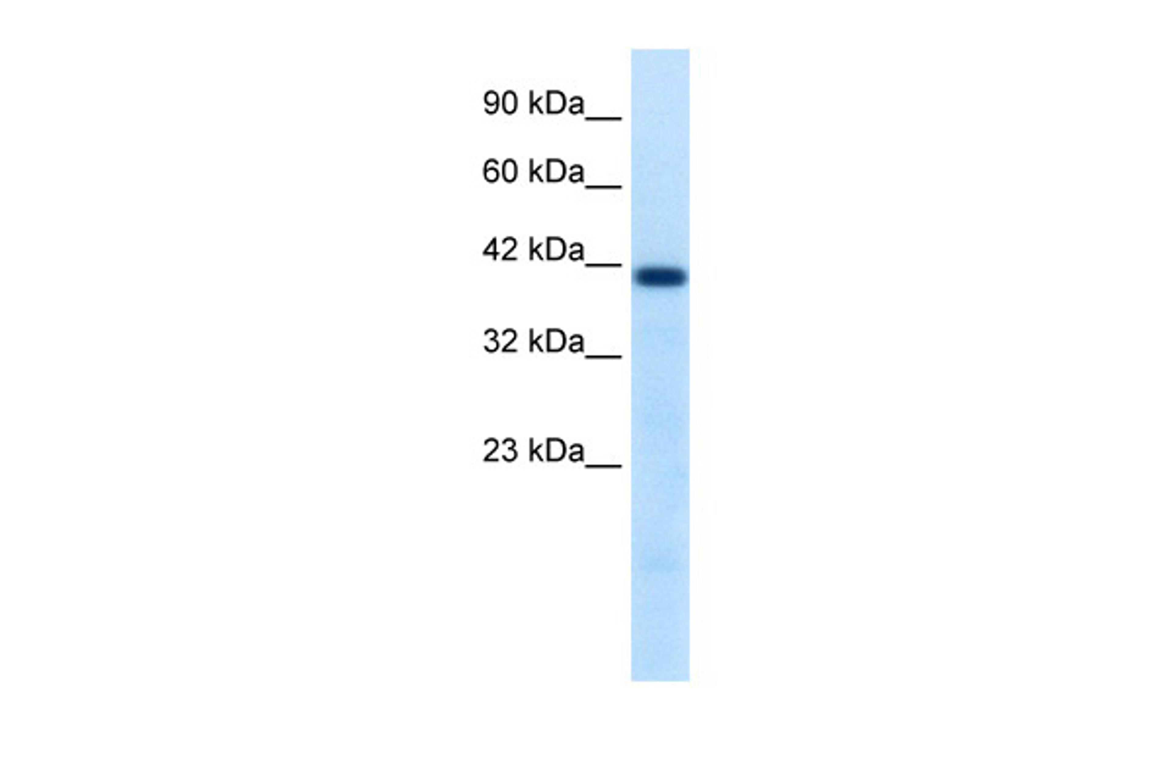 Antibody used in WB on Human Jurkat 0.2-1 ug/ml.