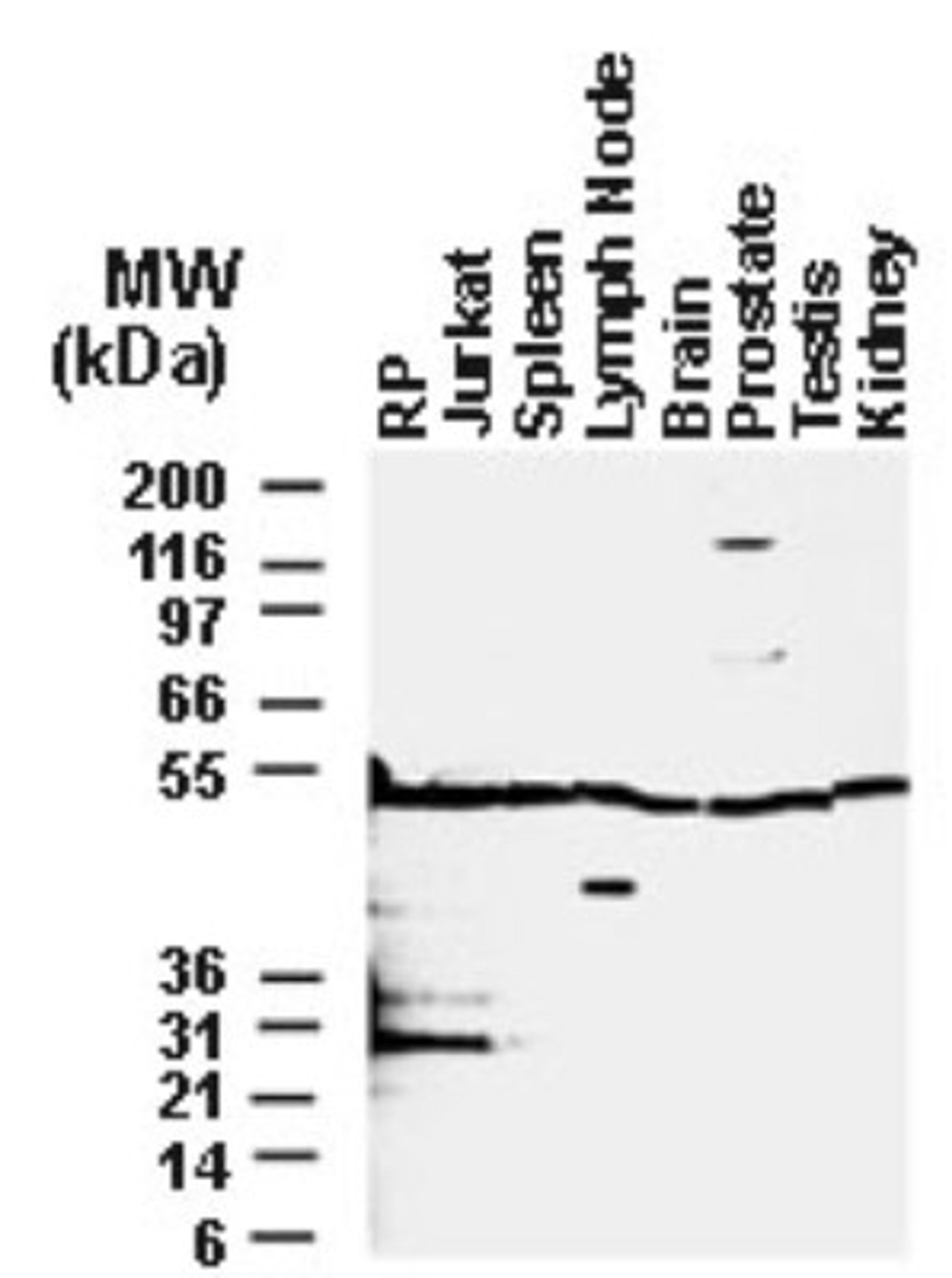 Western Blot: BFAR Antibody [NB100-56094] - Analysis of BAR in cell lines and tissues.25 ug of total protein was loaded per lane. BAR Recombinant protein (RP) was used as a positive control.