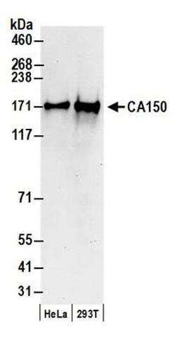 Detection of human CA150 by western blot.