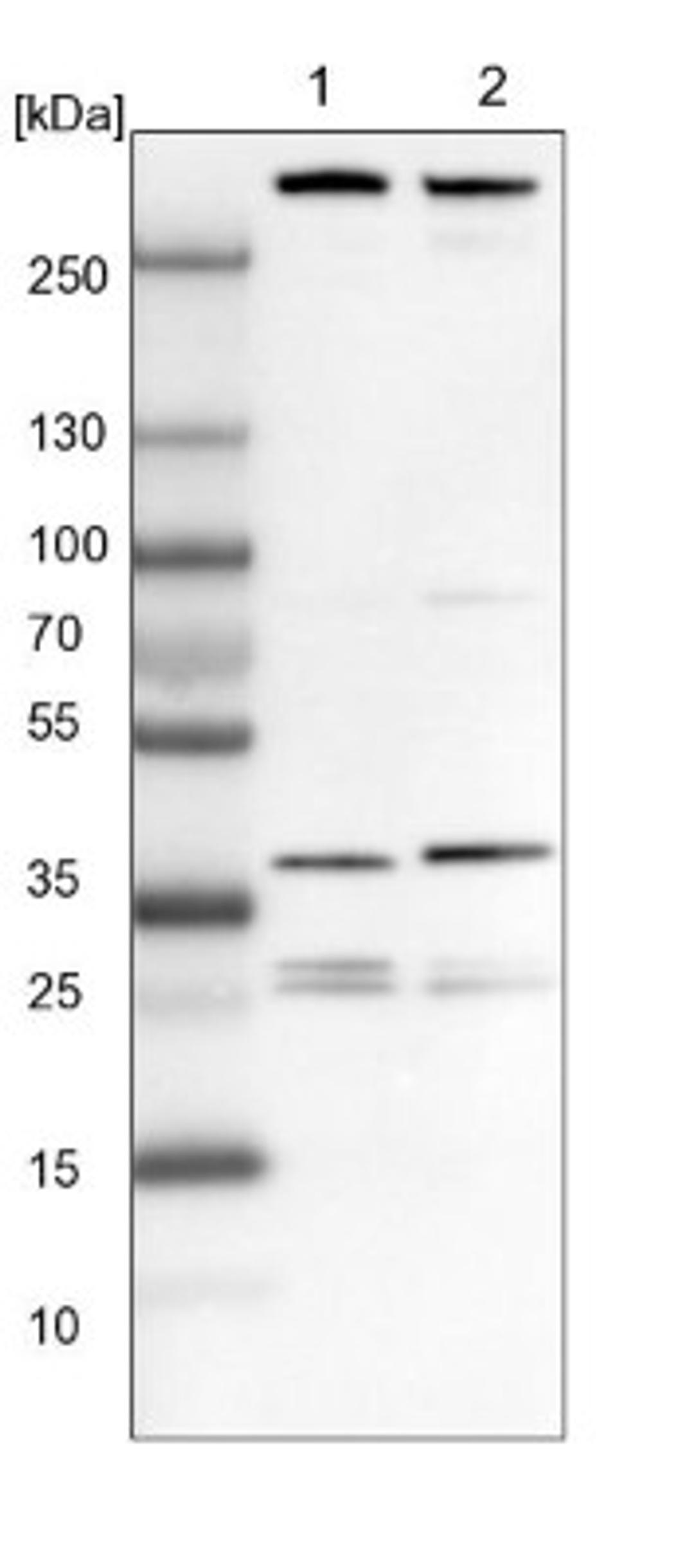 Western Blot: ECHS1 Antibody [NBP1-87078] - Lane 1: NIH-3T3 cell lysate (Mouse embryonic fibroblast cells)<br/>Lane 2: NBT-II cell lysate (Rat Wistar bladder tumour cells)