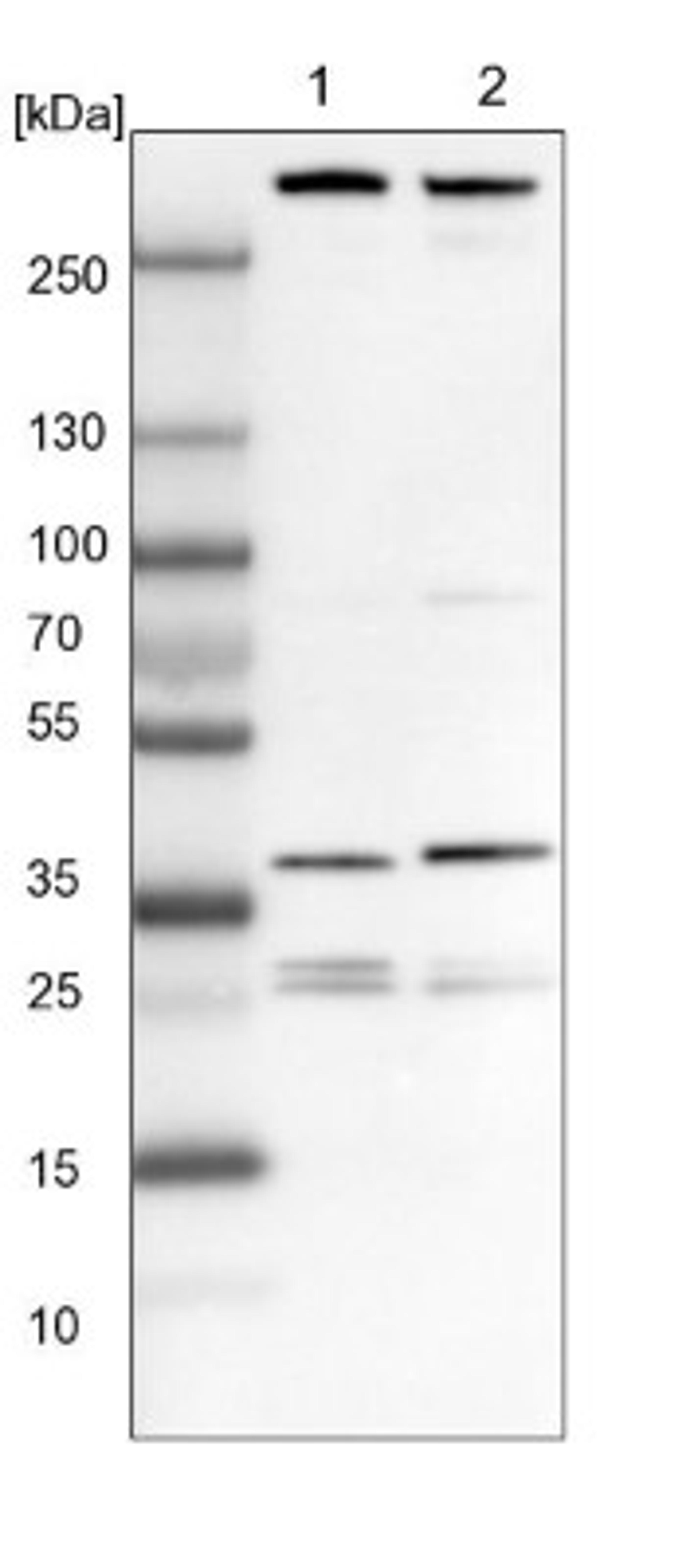 Western Blot: ECHS1 Antibody [NBP1-87078] - Lane 1: NIH-3T3 cell lysate (Mouse embryonic fibroblast cells)<br/>Lane 2: NBT-II cell lysate (Rat Wistar bladder tumour cells)