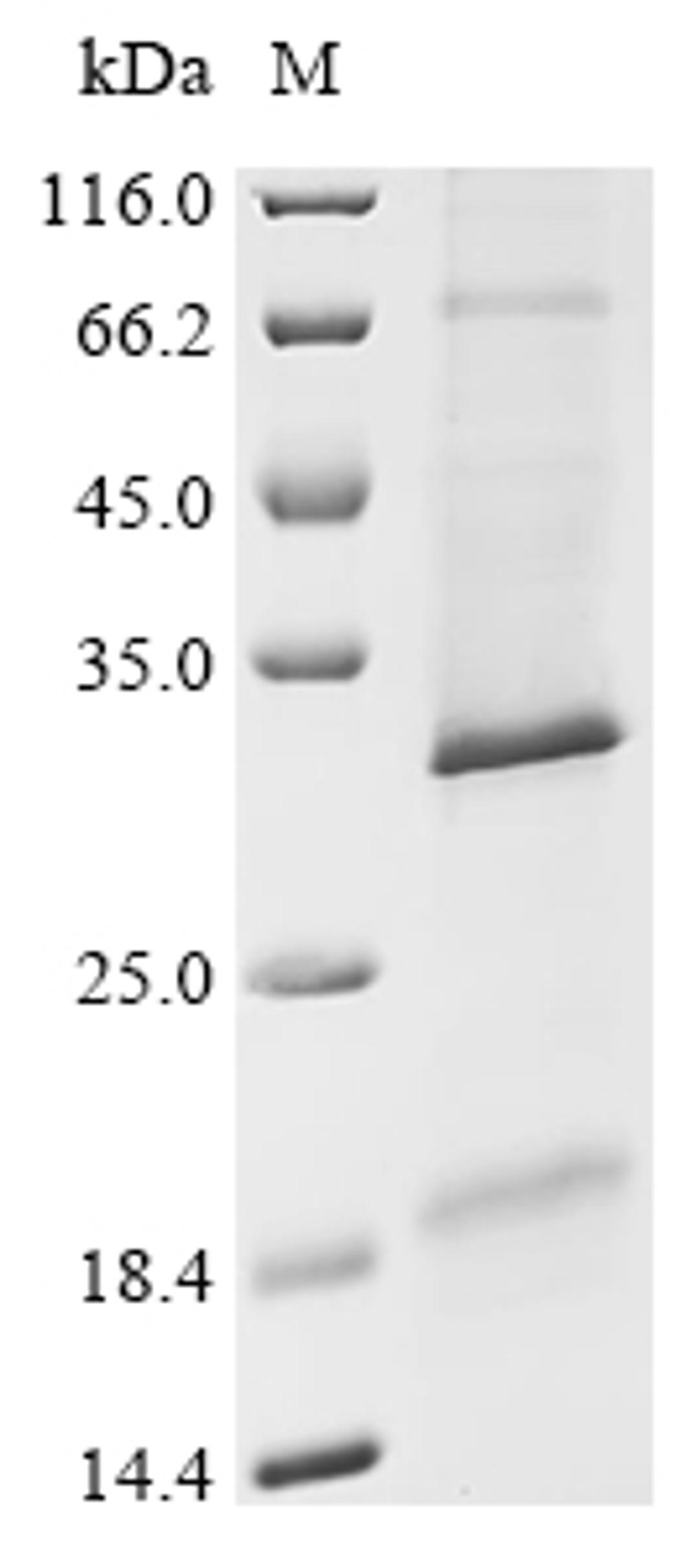 (Tris-Glycine gel) Discontinuous SDS-PAGE (reduced) with 5% enrichment gel and 15% separation gel.