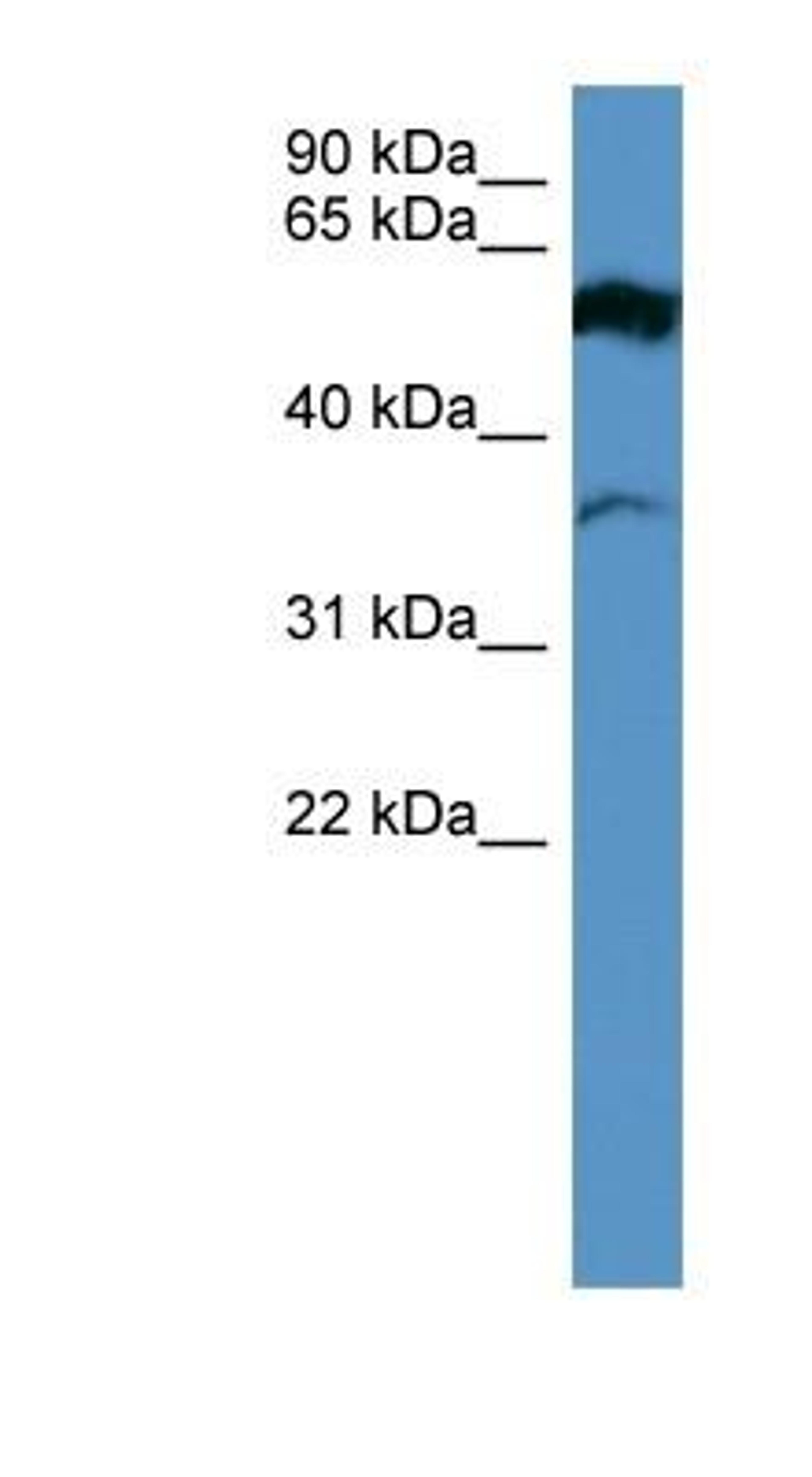 Western Blot: Fascin 2 Antibody [NBP1-79776] - Human Brain lysate, concentration 0.2-1 ug/ml.