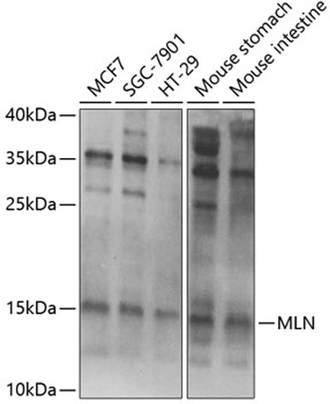 Western blot - MLN Antibody (A6388)