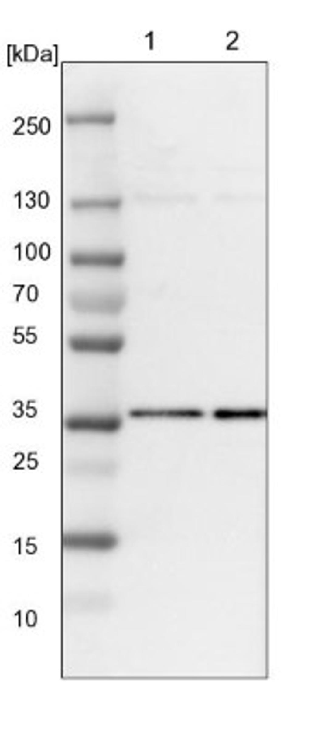 Western Blot: HCA59 Antibody [NBP1-83168] - Lane 1: NIH-3T3 cell lysate (Mouse embryonic fibroblast cells)<br/>Lane 2: NBT-II cell lysate (Rat Wistar bladder tumour cells)