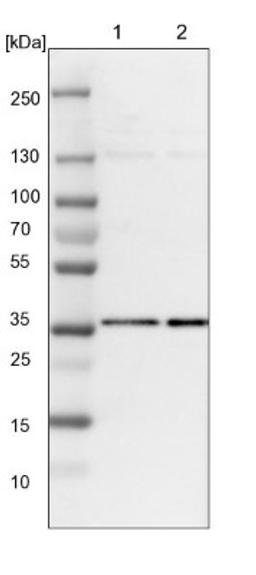 Western Blot: HCA59 Antibody [NBP1-83168] - Lane 1: NIH-3T3 cell lysate (Mouse embryonic fibroblast cells)<br/>Lane 2: NBT-II cell lysate (Rat Wistar bladder tumour cells)