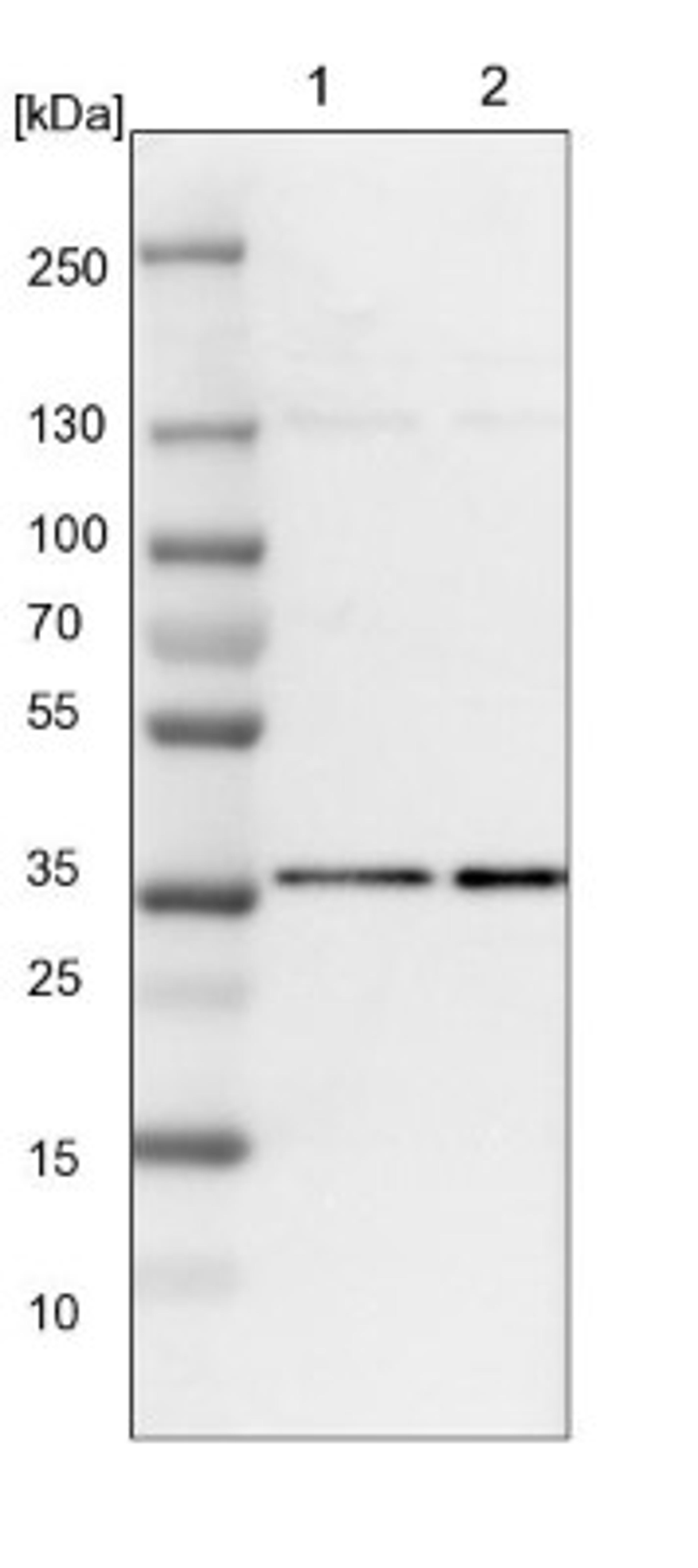 Western Blot: HCA59 Antibody [NBP1-83168] - Lane 1: NIH-3T3 cell lysate (Mouse embryonic fibroblast cells)<br/>Lane 2: NBT-II cell lysate (Rat Wistar bladder tumour cells)