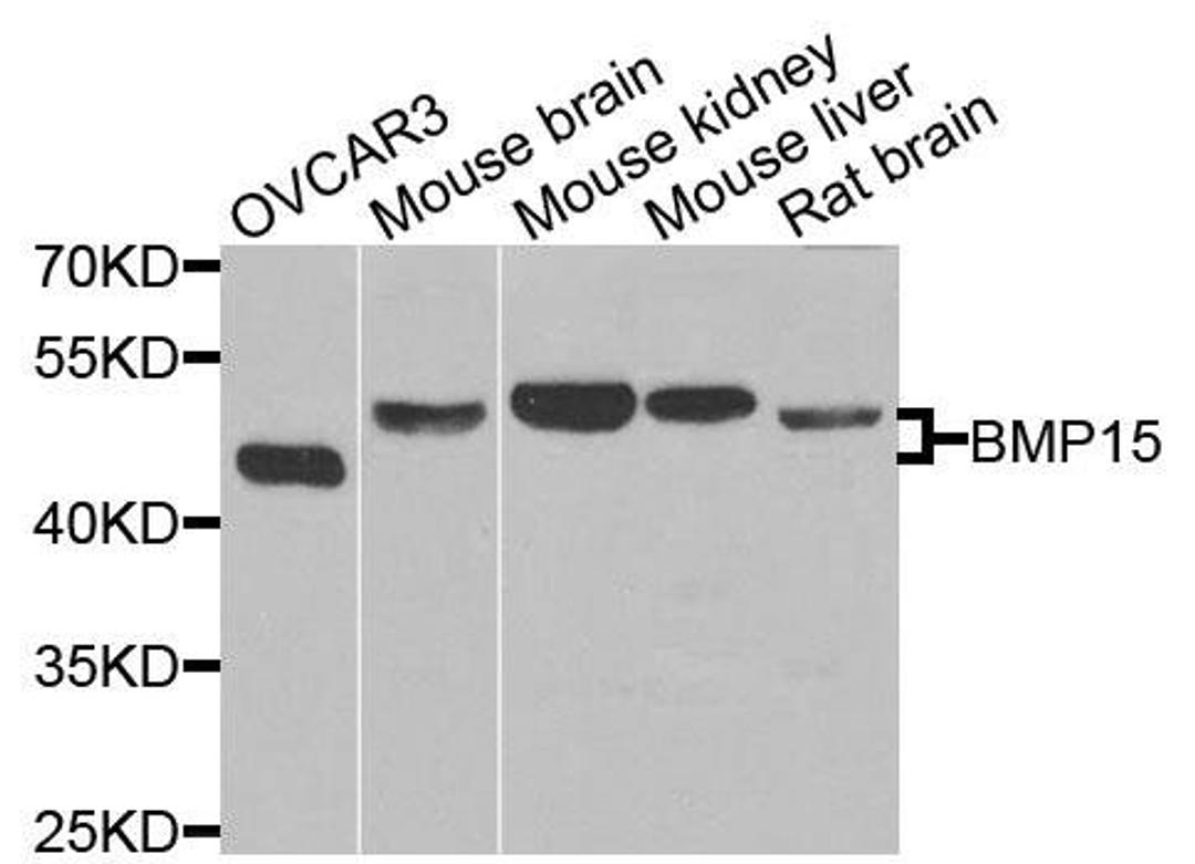 Western blot analysis of extracts of various cells using BMP15 antibody