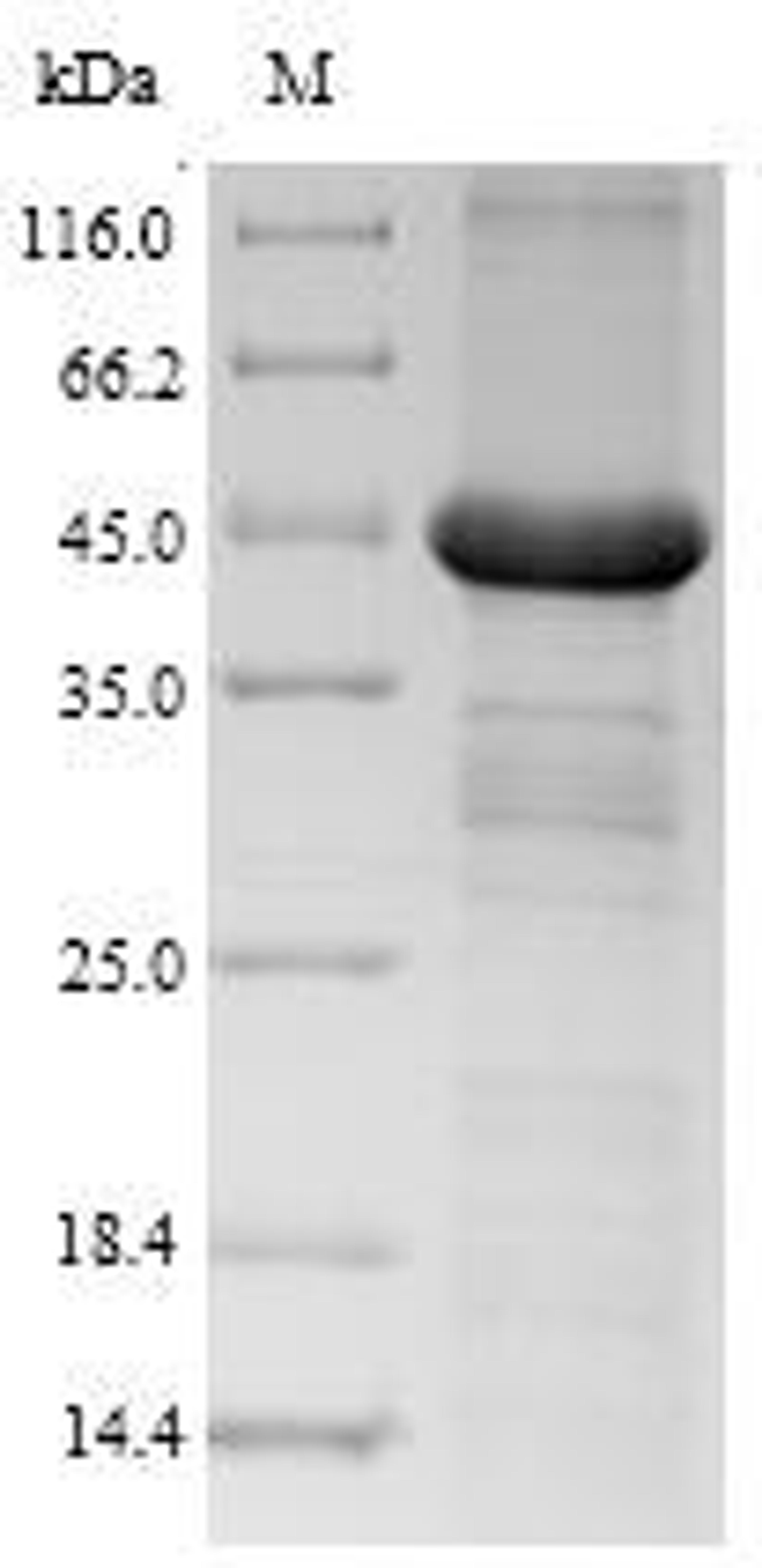 (Tris-Glycine gel) Discontinuous SDS-PAGE (reduced) with 5% enrichment gel and 15% separation gel.