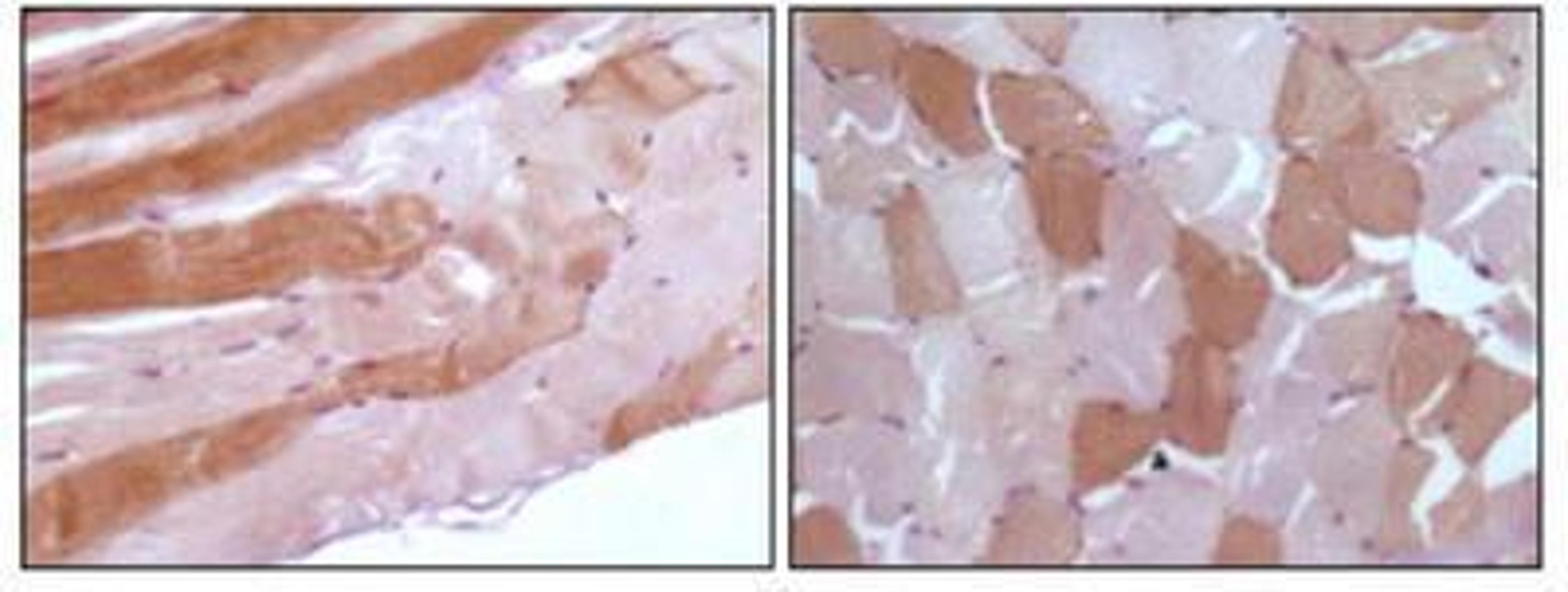 Immunohistochemistry: Myoglobin Antibody (4D7H3) [NB110-89456] - Immunohistochemical analysis of paraffin-embedded human skeletal muscle tissue showing cytoplasmic localization using anti-Myoglobin antibody with DAB staining.