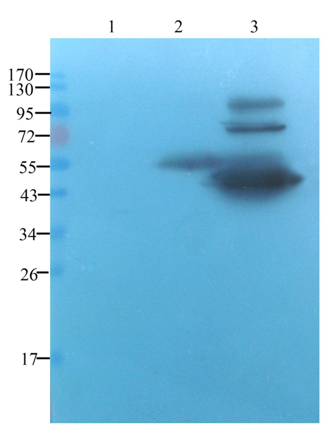 WB analysis of rat lung (lane 1), human breast cancer (lane 2), human thyroid cancer (lane 3) using Tissur factor antibody (1 ug/ml)