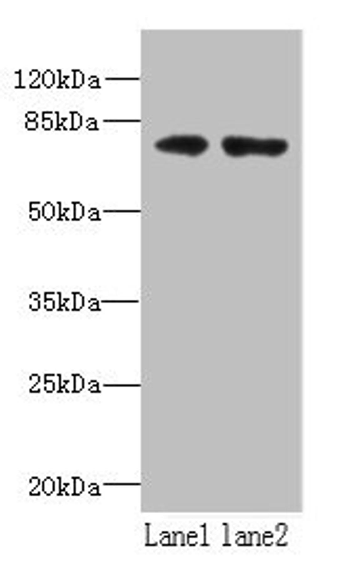 Western blot. All lanes: WDTC1 antibody at 1.5µg/ml. Lane 1: A431 whole cell lysate. Lane 2: Mouse liver tissue. Secondary. Goat polyclonal to rabbit IgG at 1/10000 dilution. Predicted band size: 76, 70, 68, 69 kDa. Observed band size: 76 kDa
