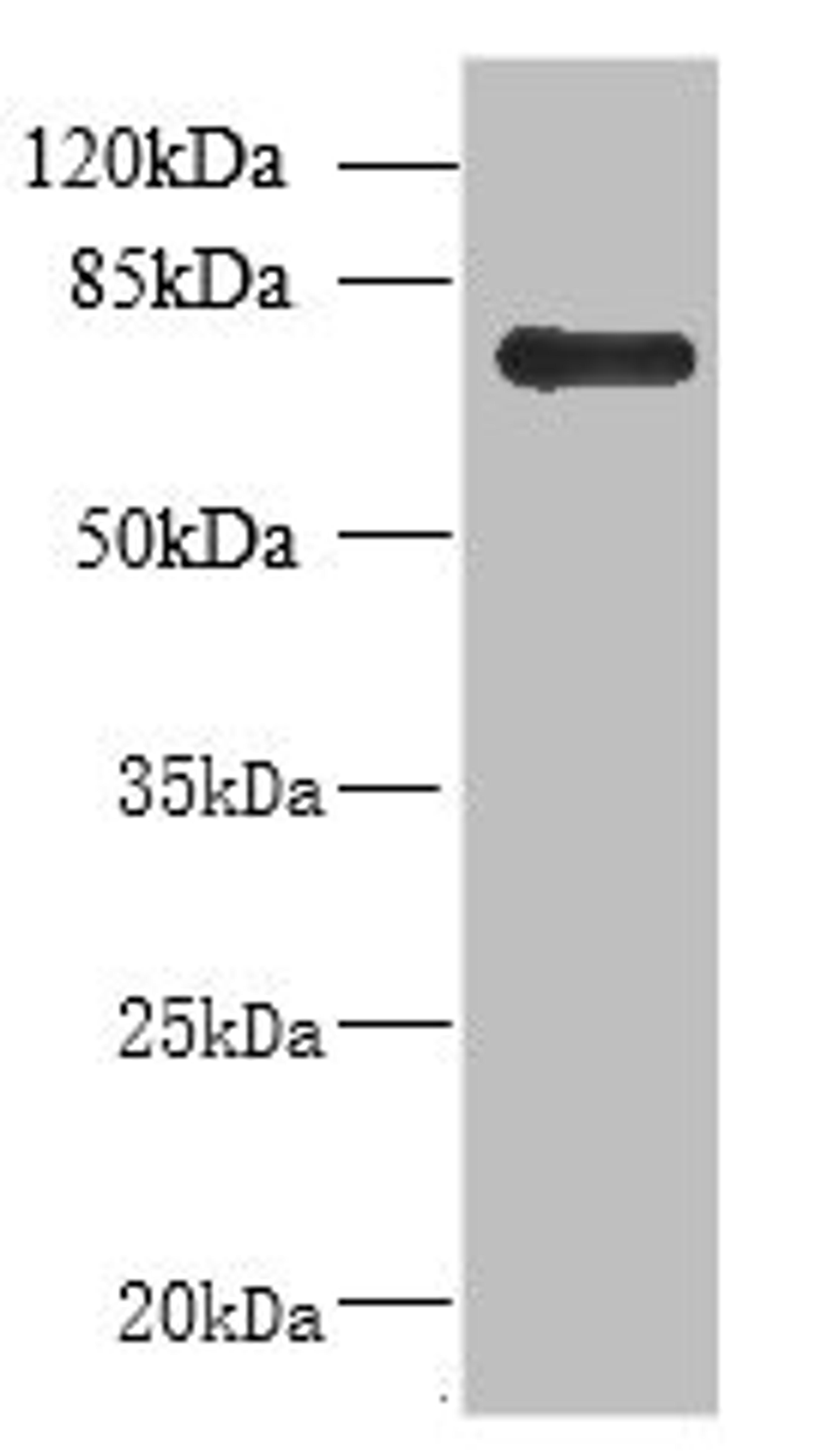 Western blot. All lanes: NHLRC2 antibody at 8µg/ml + U251 whole cell lysate. Secondary. Goat polyclonal to rabbit at 1/10000 dilution. Predicted band size: 80, 40 kDa. Observed band size: 80 kDa