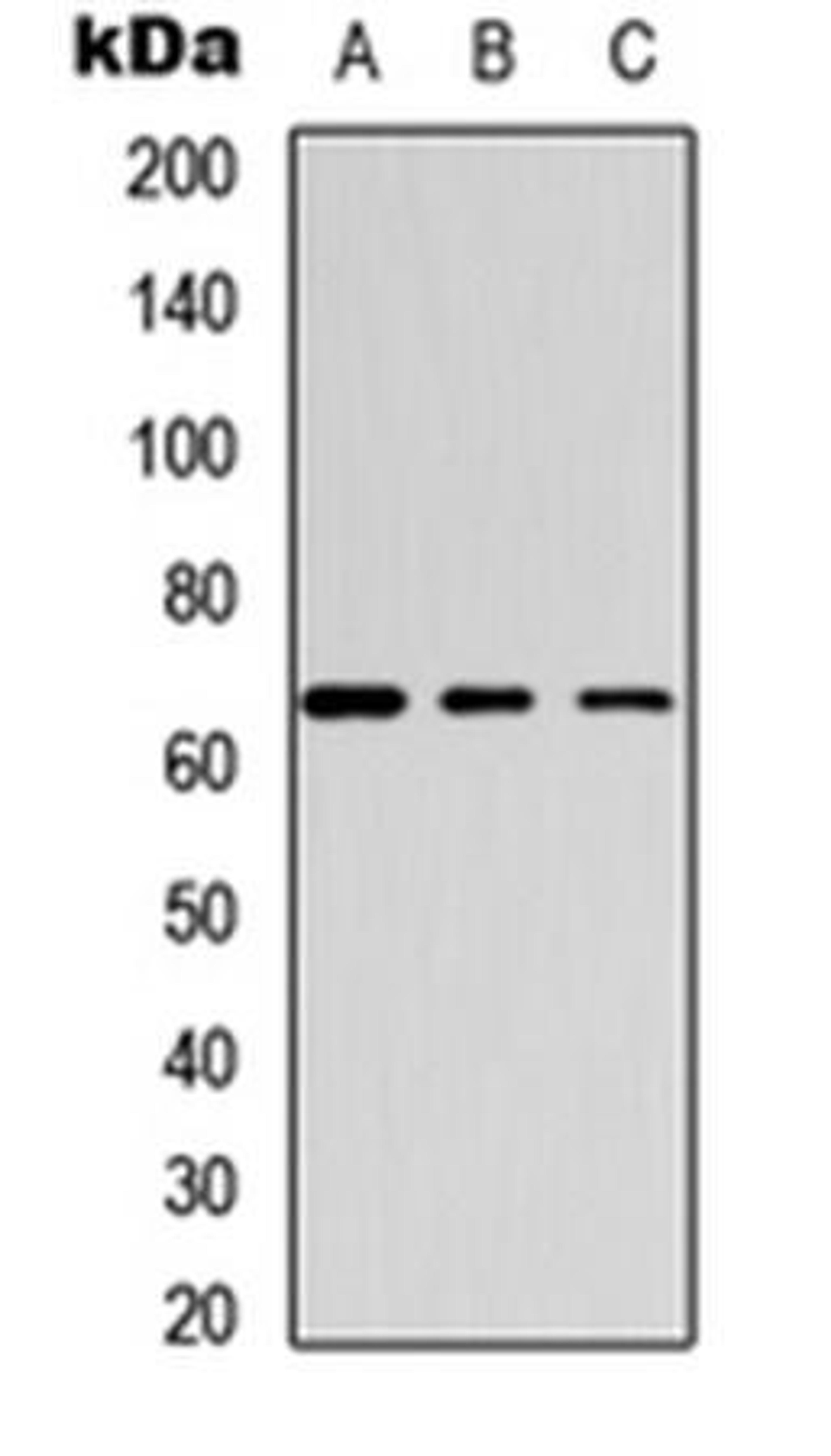 Western blot analysis of HeLa (Lane1), mouse brain (Lane2), rat brain (Lane3) whole cell using GABRB1 (phospho-S434) antibody