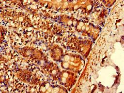 Immunohistochemistry of paraffin-embedded human small intestine tissue using CSB-PA867130LA01HU at dilution of 1:100