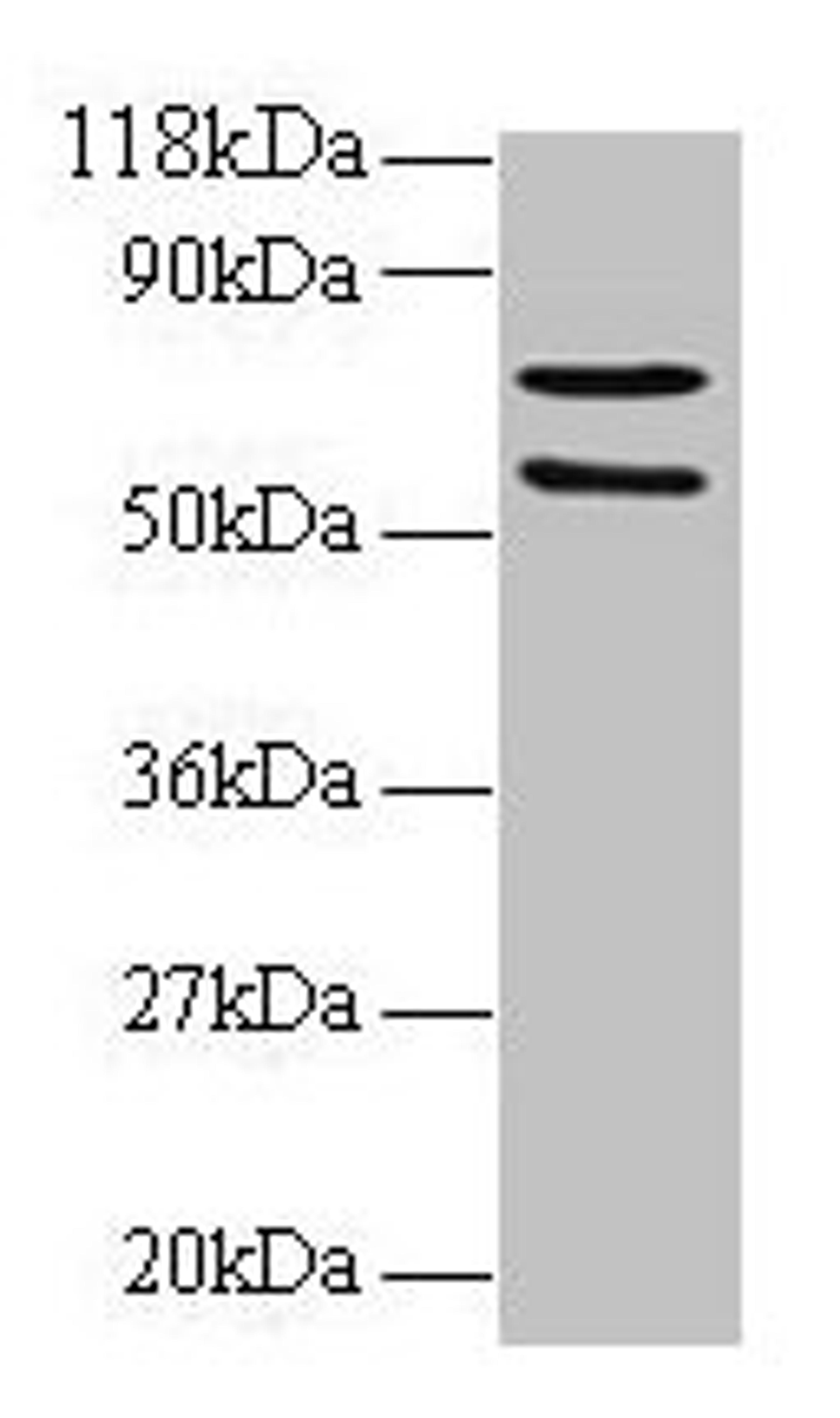 Western blot. All lanes: SDHA antibody at 2µg/ml + 293T whole cell lysate. Secondary. Goat polyclonal to rabbit IgG at 1/15000 dilution. Predicted band size: 73, 68, 57 kDa. Observed band size: 73, 57 kDa