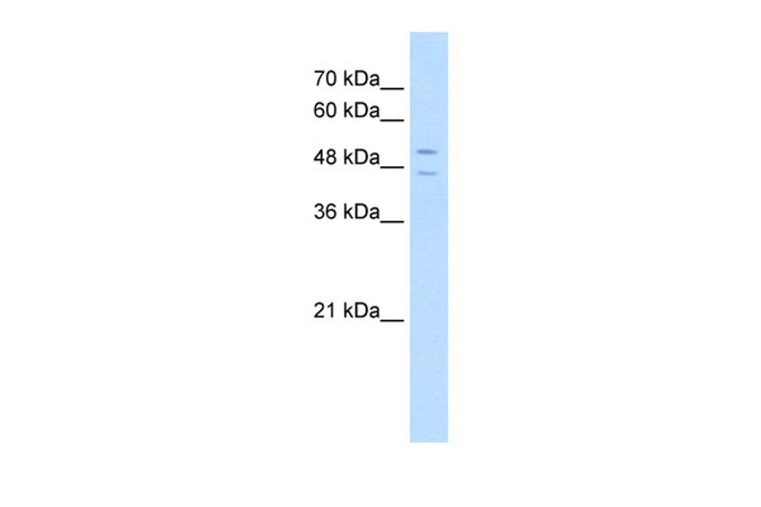 Antibody used in WB on Human HepG2 at 5.0 ug/ml.