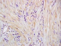  Immunohistochemical analysis of formalin-fixed paraffin embedded human cervical tissue using SM22 alpha antibody