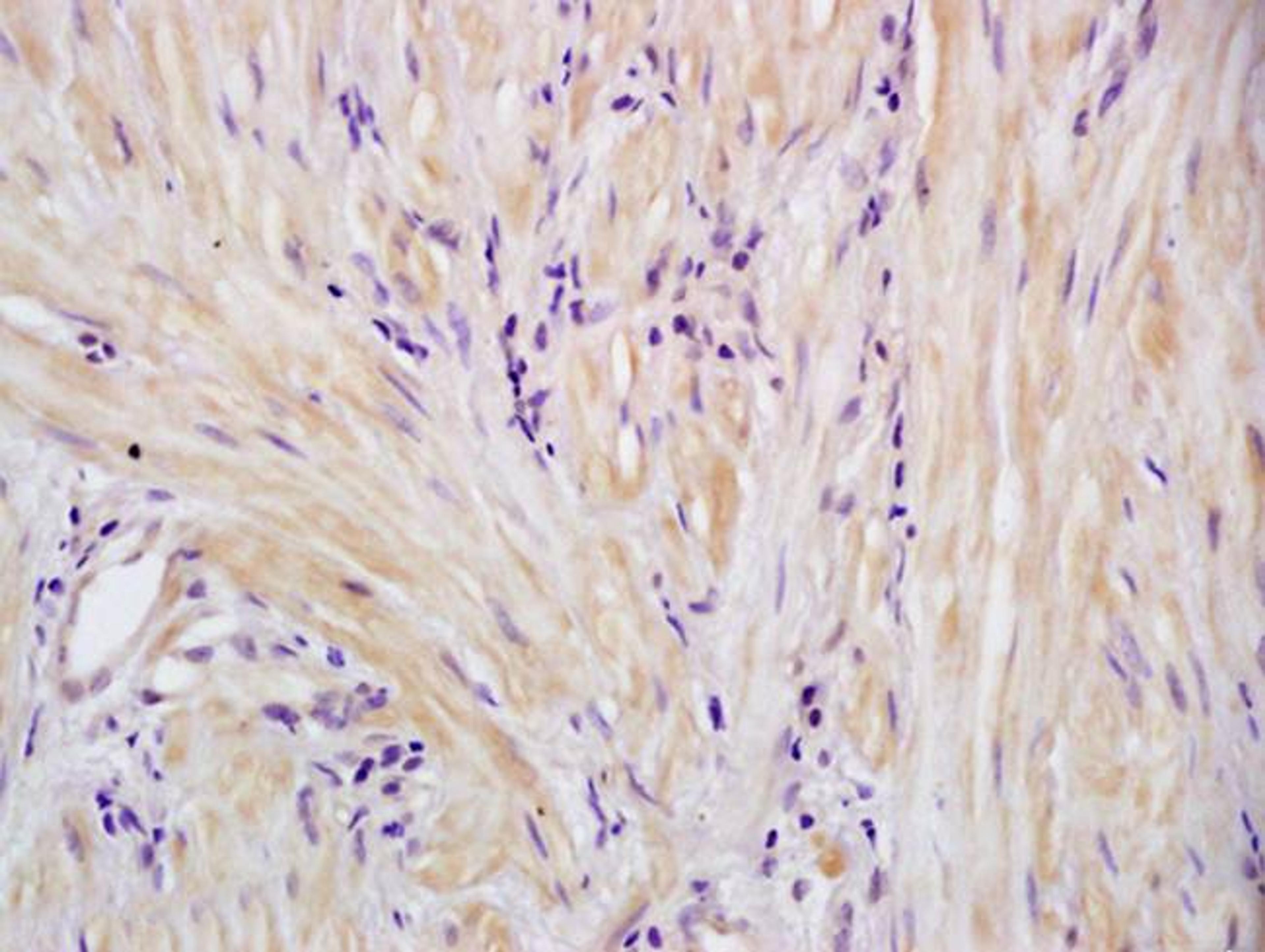 Immunohistochemical analysis of formalin-fixed paraffin embedded human cervical tissue using SM22 alpha antibody