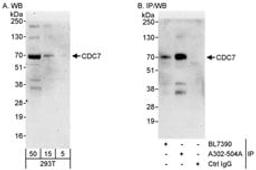 Detection of human CDC7 by western blot and immunoprecipitation.