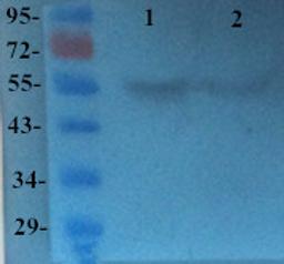 Western blot analysis of Human breast cancer 1 (Lane 1), Human breast cancer 2 (Lane 2) using TGF beta Receptor 2 (dilution of primary antibody - 2 ug/ml)