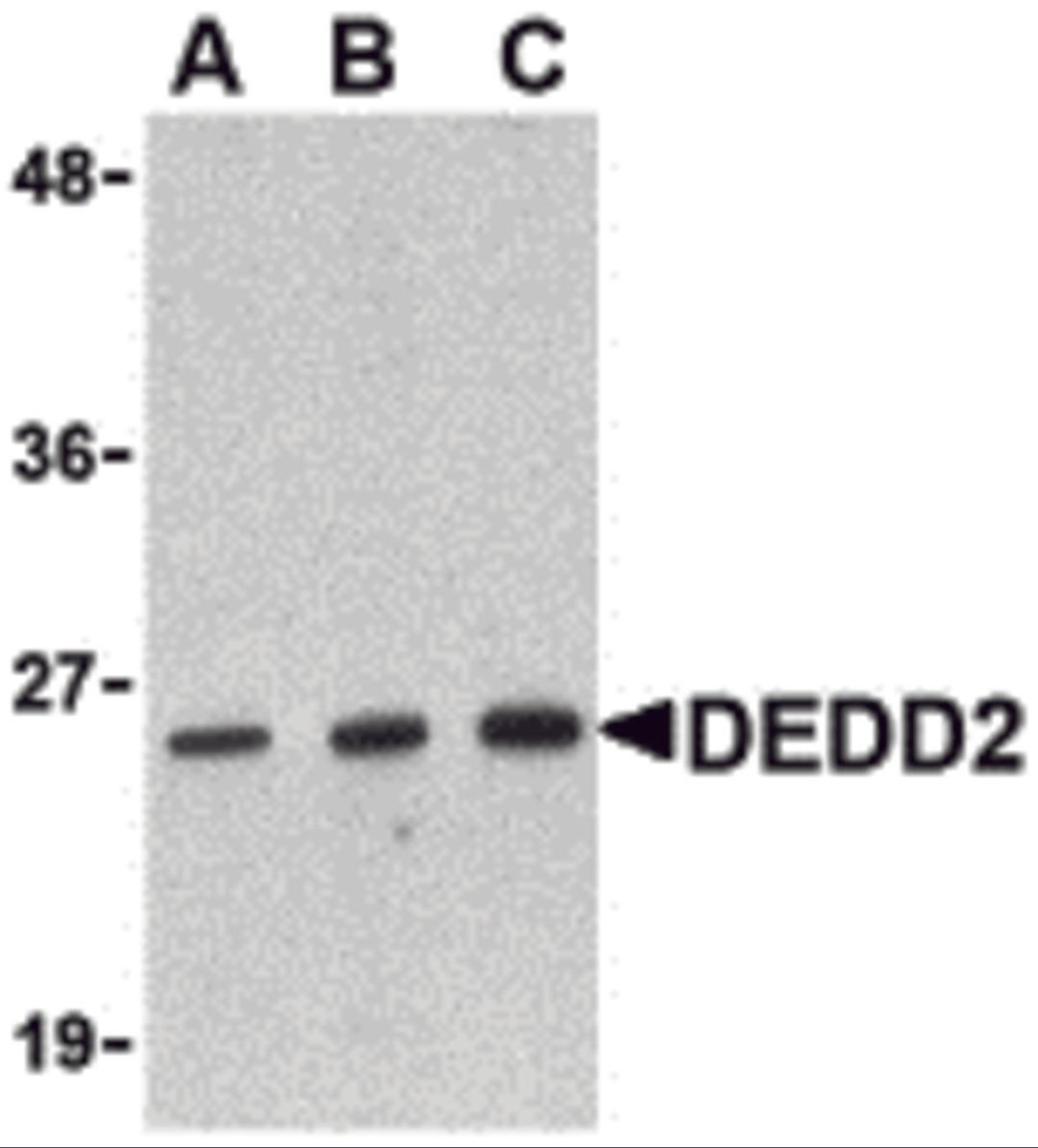 Western blot analysis of DEDD2 in RAW264.7 cell lysate with DEDD2 antibody at (A) 0.5, (B) 1 and (C) 2 μg/mL.