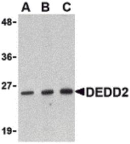 Western blot analysis of DEDD2 in RAW264.7 cell lysate with DEDD2 antibody at (A) 0.5, (B) 1 and (C) 2 μg/mL.