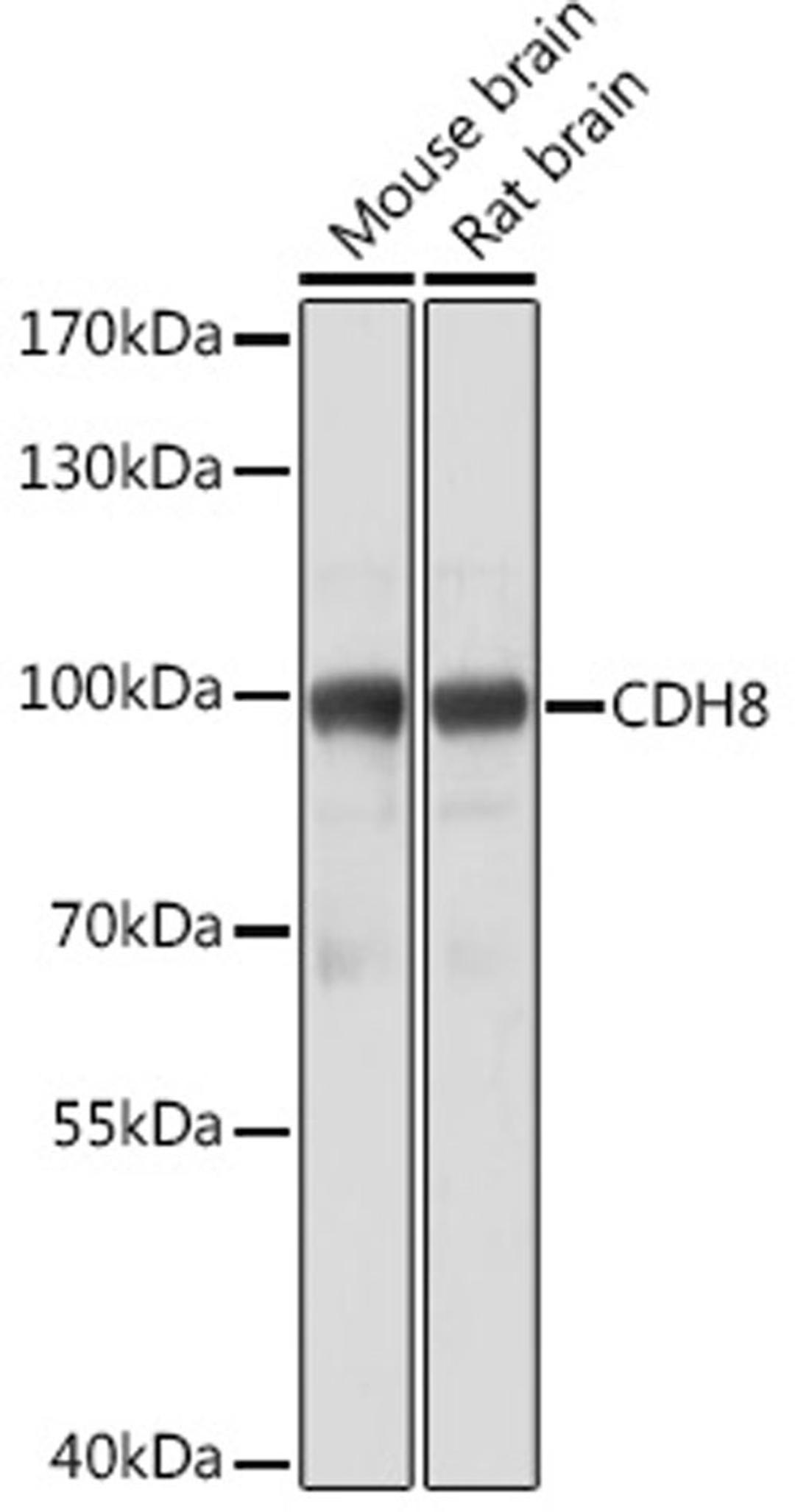 Western blot - CDH8 Rabbit pAb (A18691)