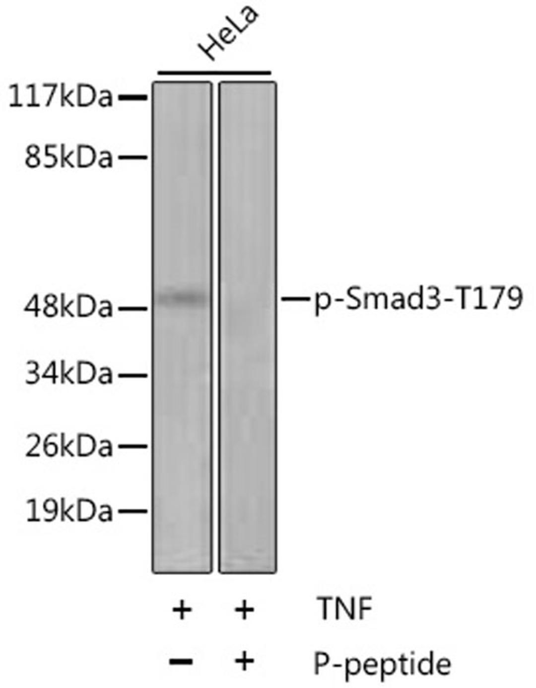 Western blot - Phospho-Smad3-T179 antibody (AP0554)