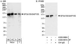 Detection of human SF3b155/SAP155 by western blot and immunoprecipitation.