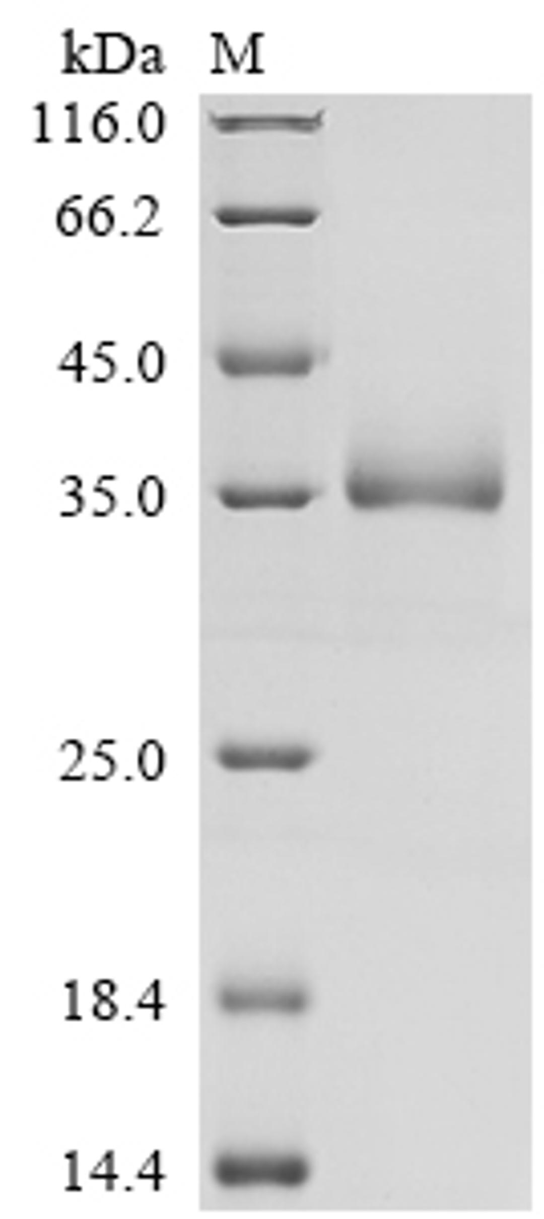 (Tris-Glycine gel) Discontinuous SDS-PAGE (reduced) with 5% enrichment gel and 15% separation gel.