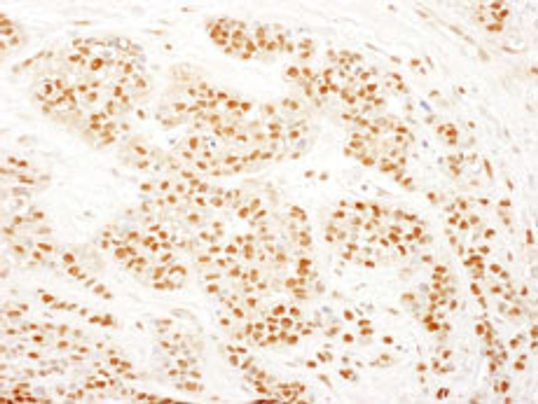 Detection of human RAD23B by immunohistochemistry.